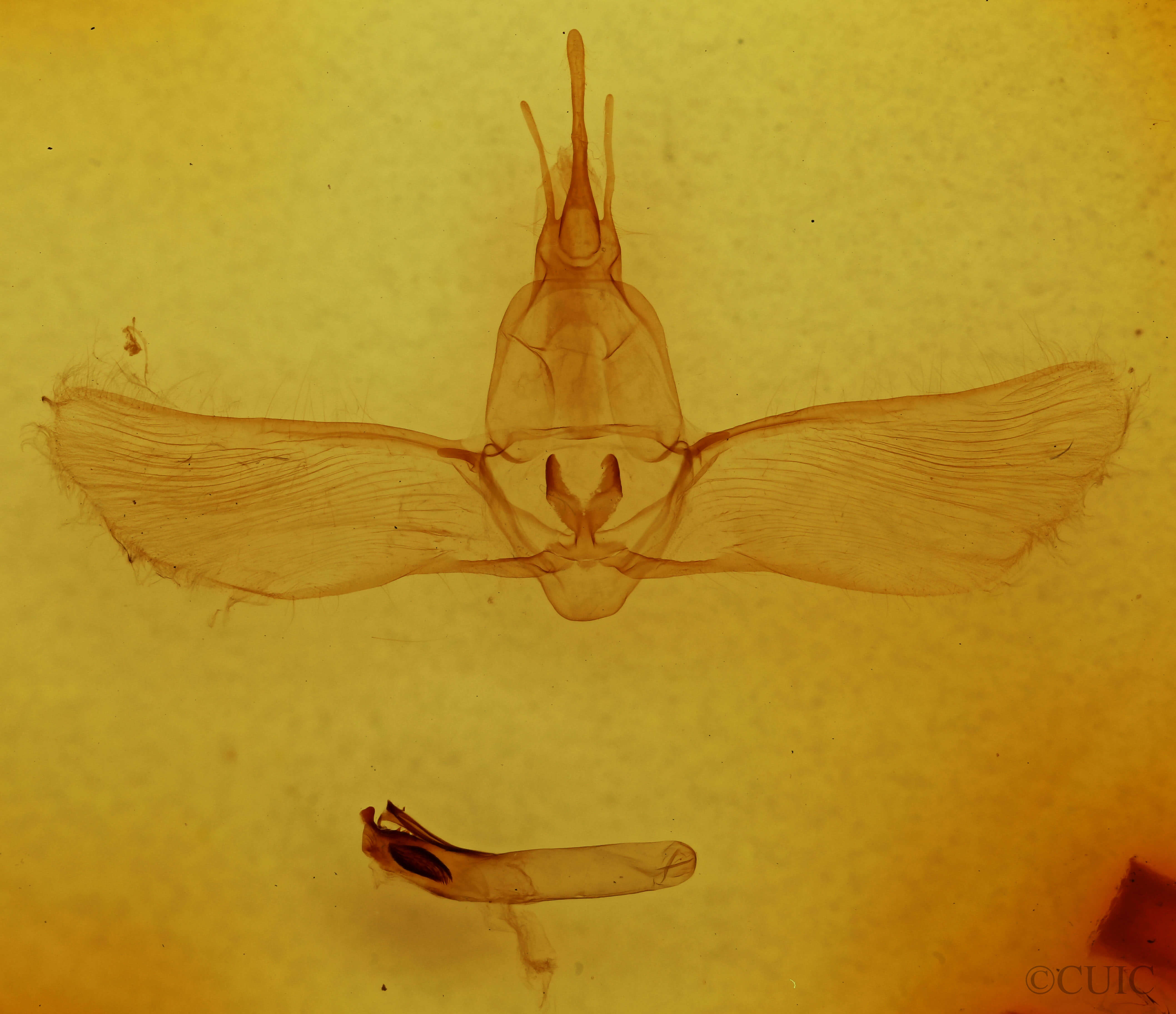 genitalia view of adult Pseudothyatira cymatophoroides