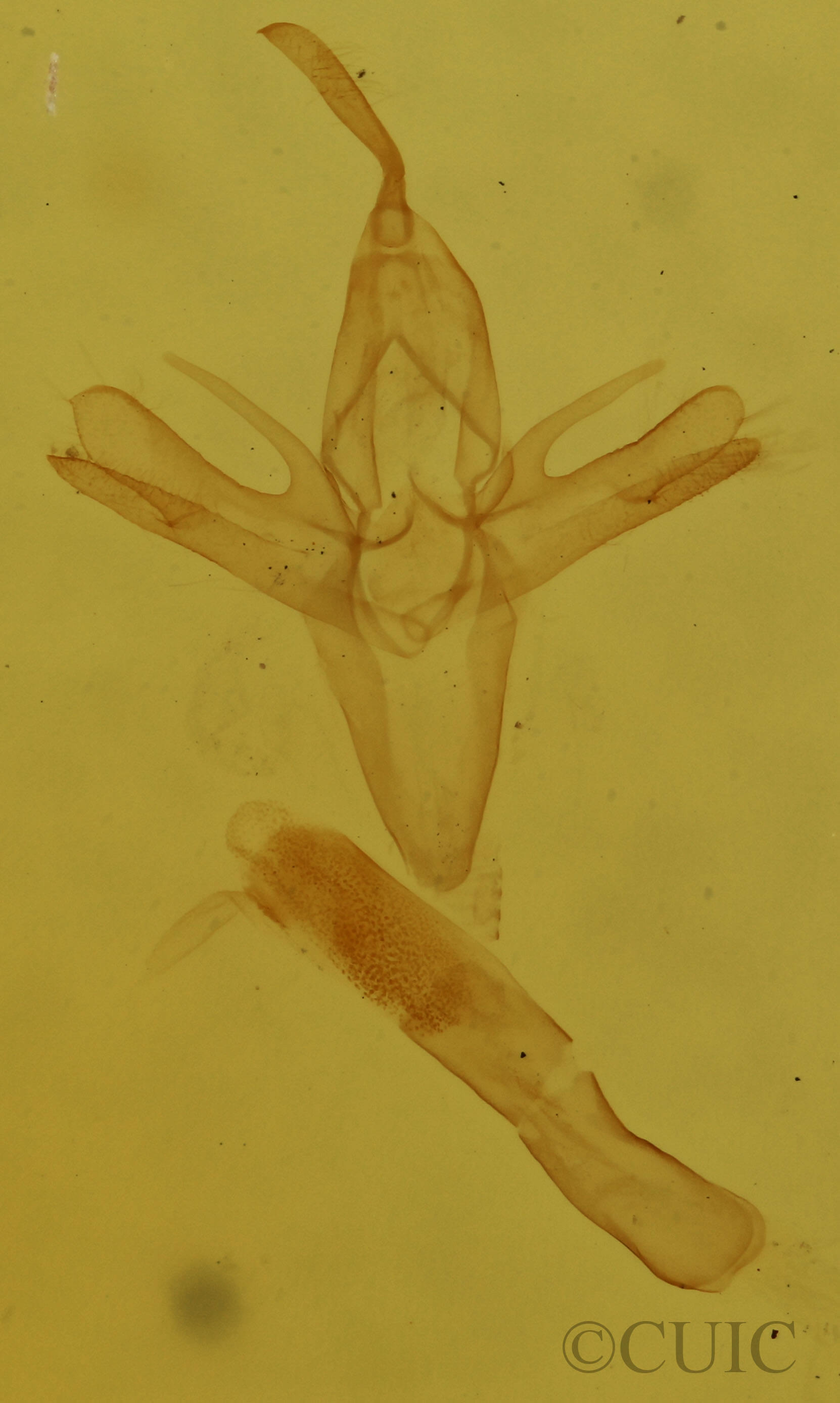genitalia view of adult Renia factiosalis