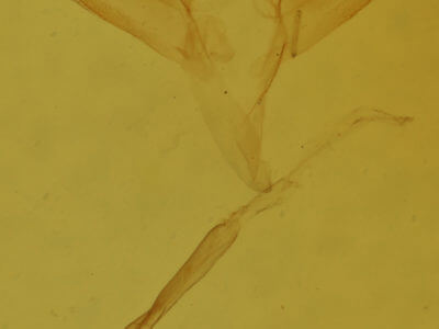 genitalia view of adult Renia adspergillus