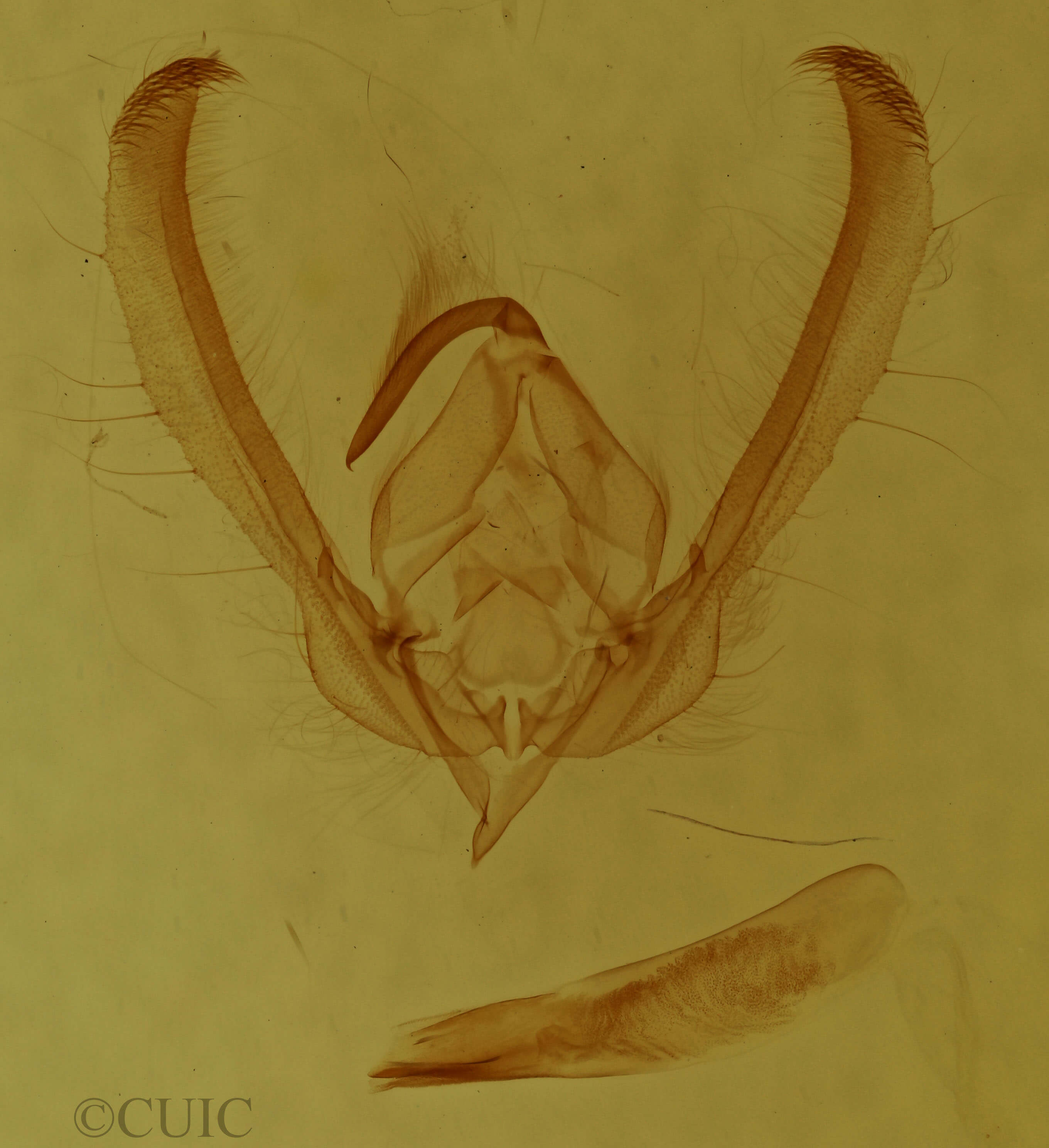 genitalia view of adult Schinia rivulosa
