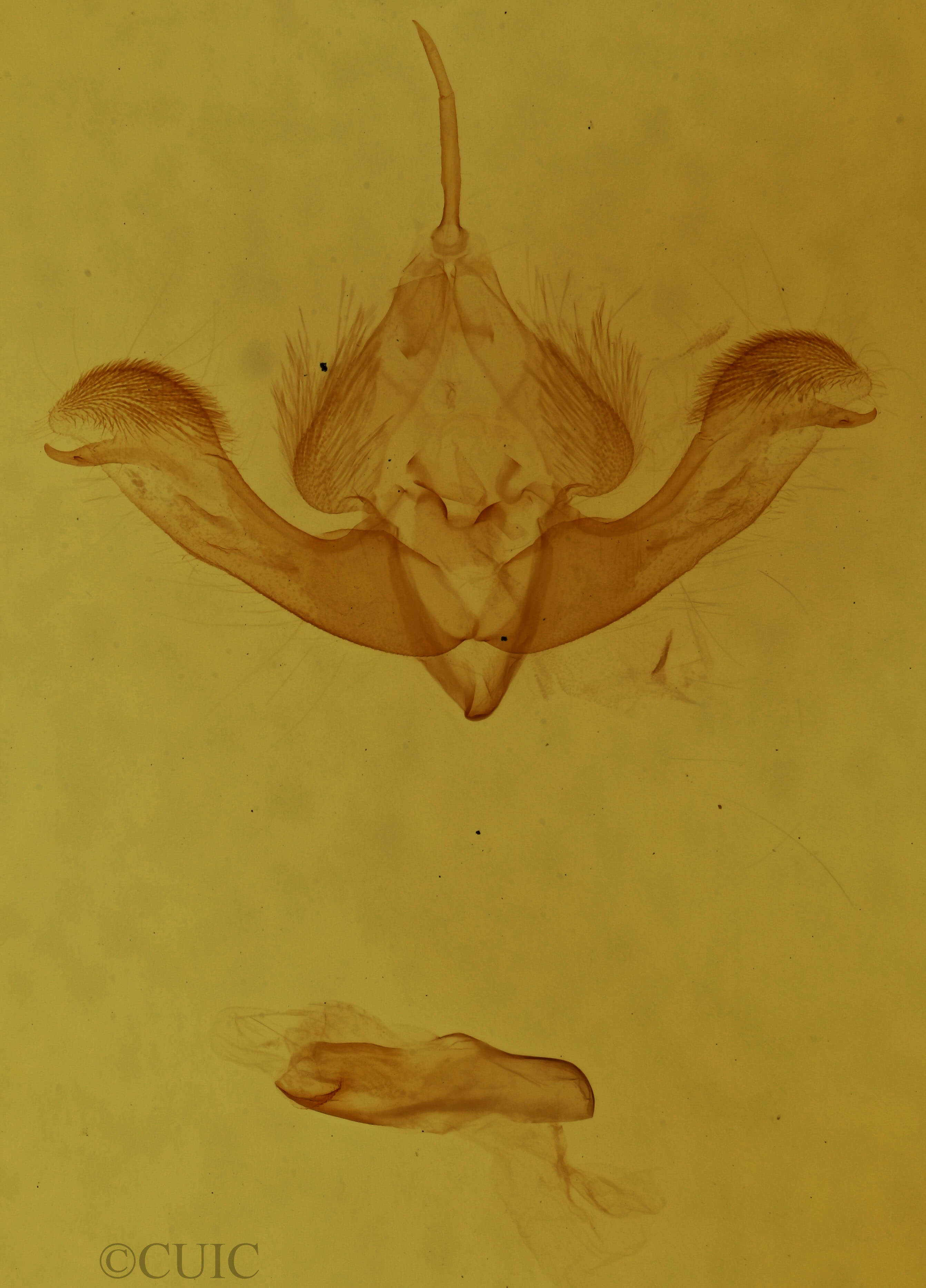 genitalia view of adult Selambina trajiciens