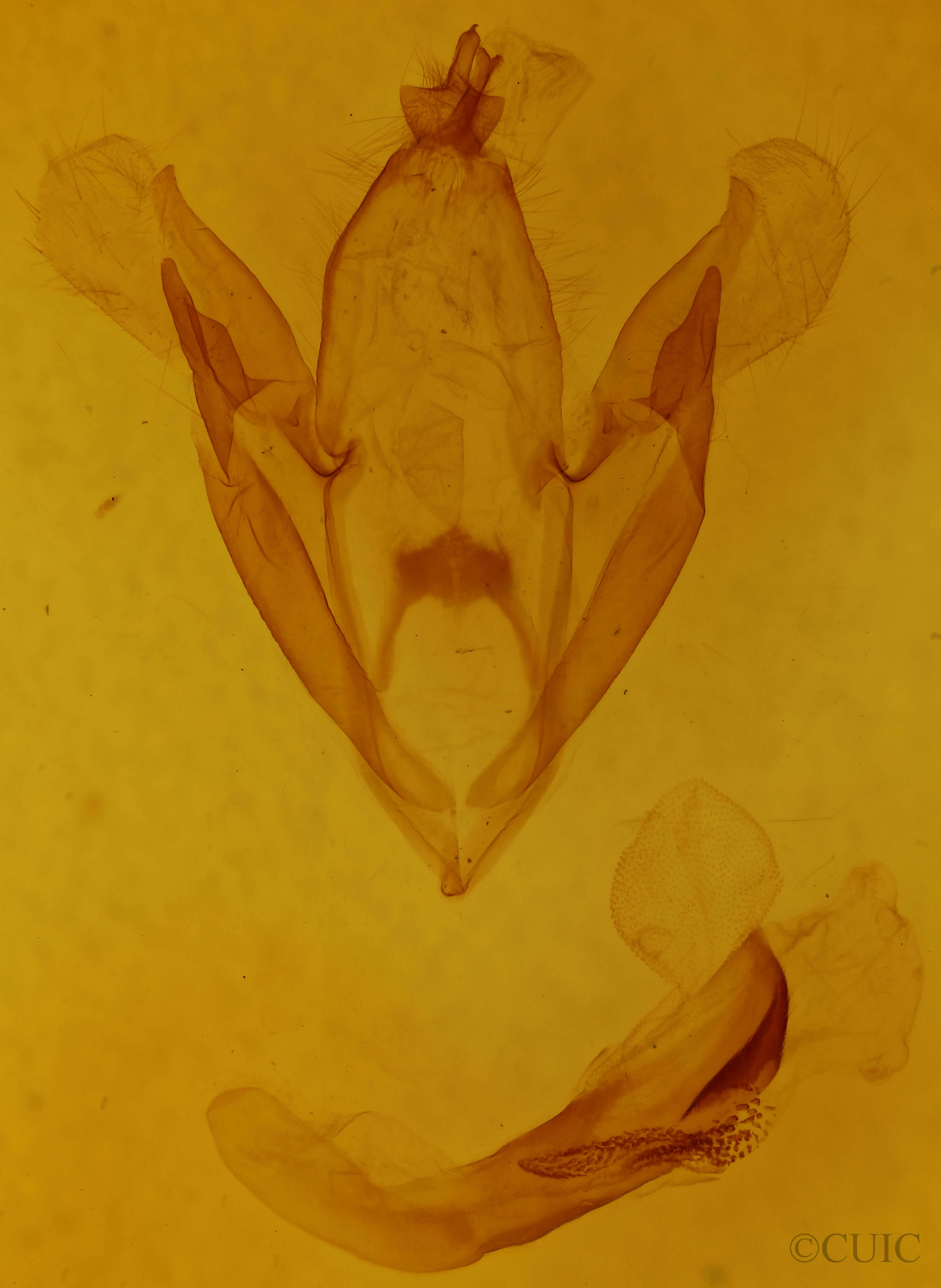 genitalia view of adult Spiloloma lunilinea