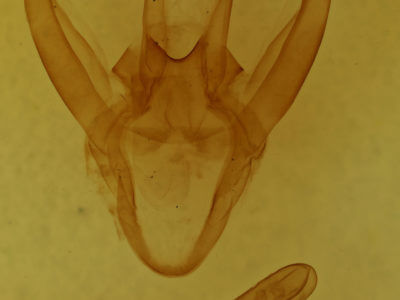 genitalia view of adult Spilosoma congrua