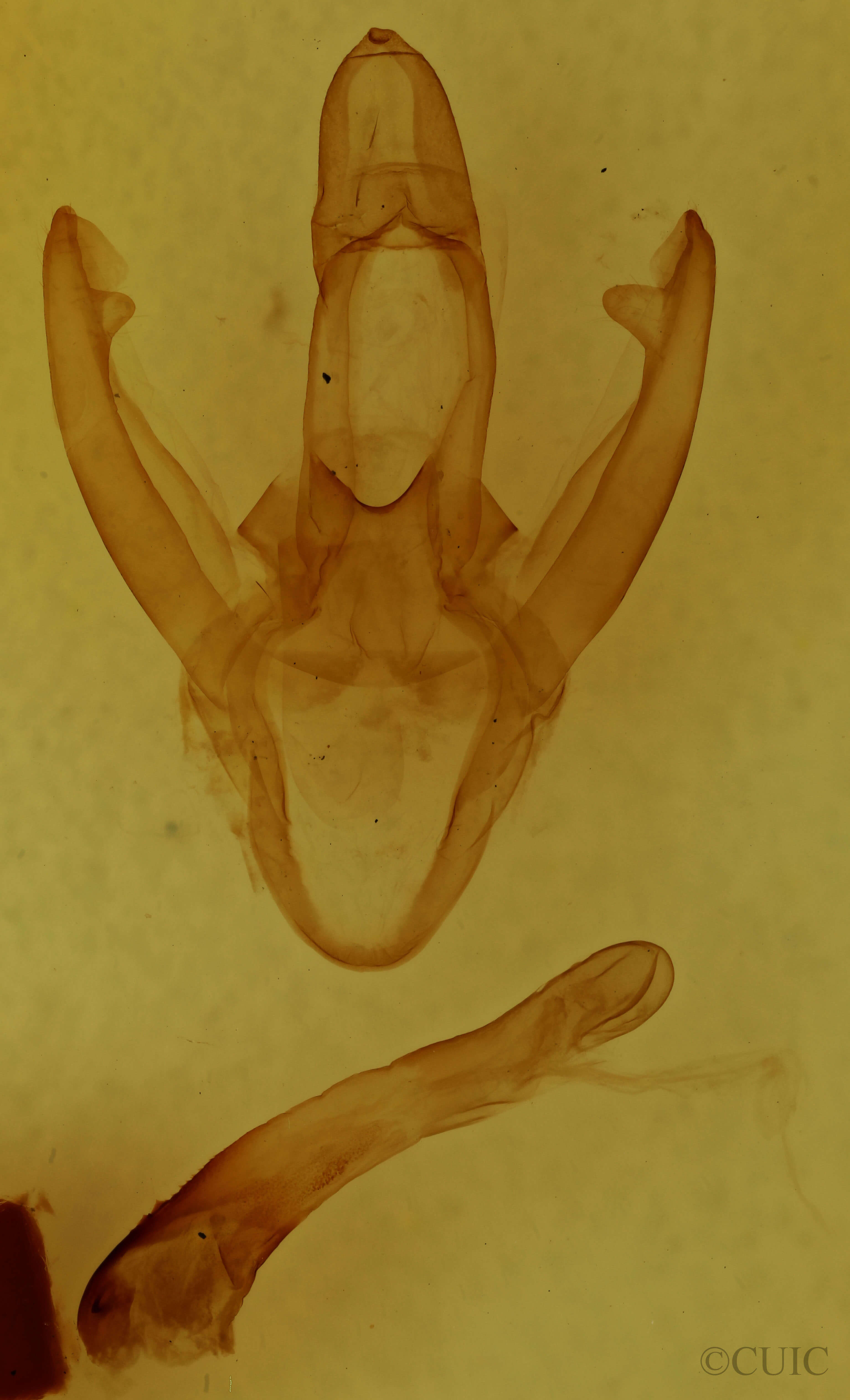 genitalia view of adult Spilosoma congrua