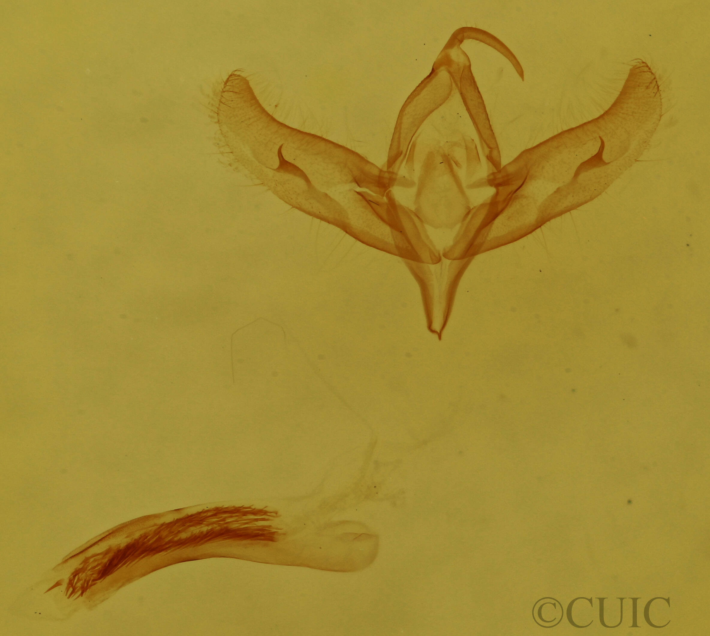 genitalia view of adult Stylopoda