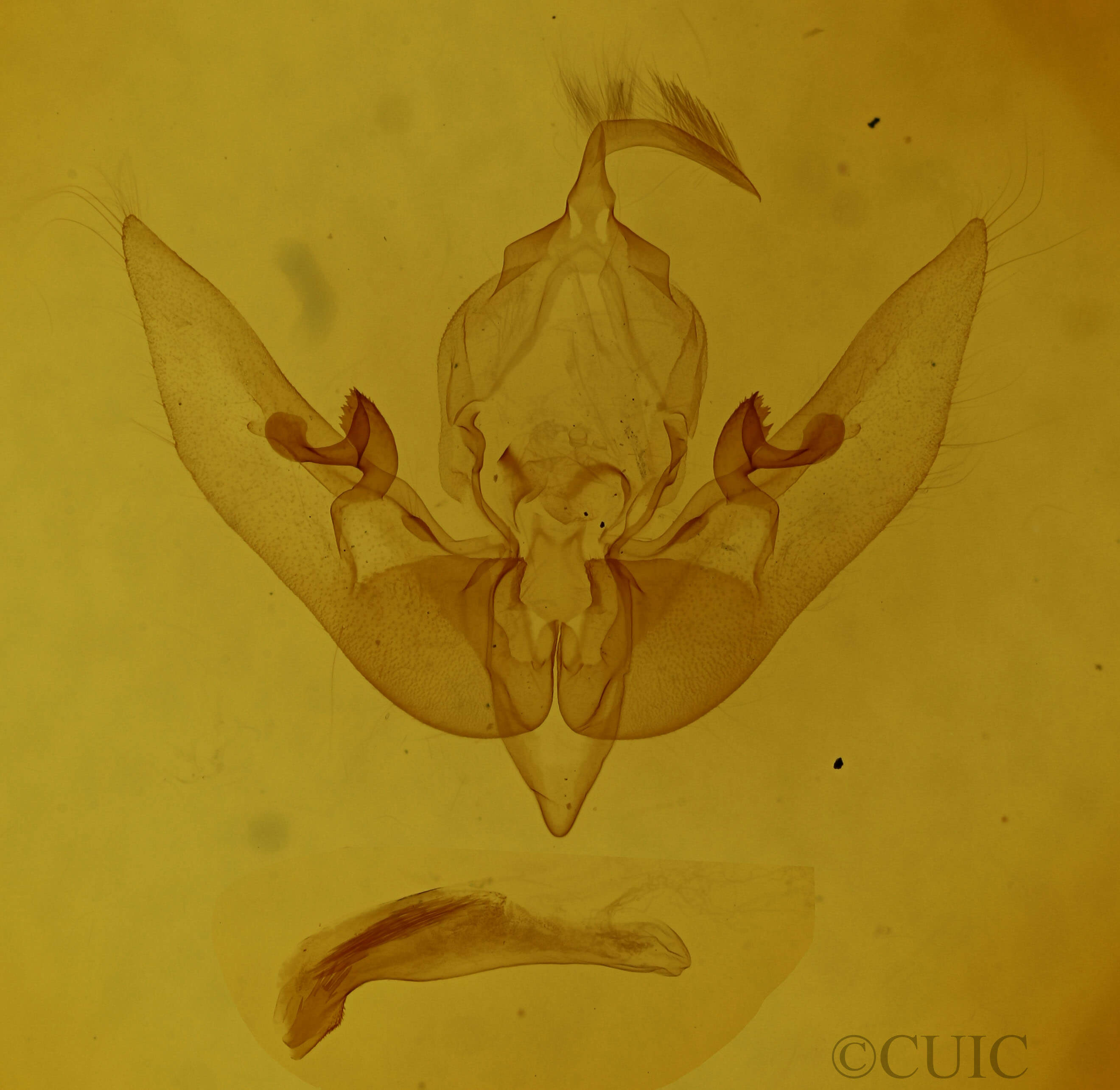 genitalia view of adult Sunira