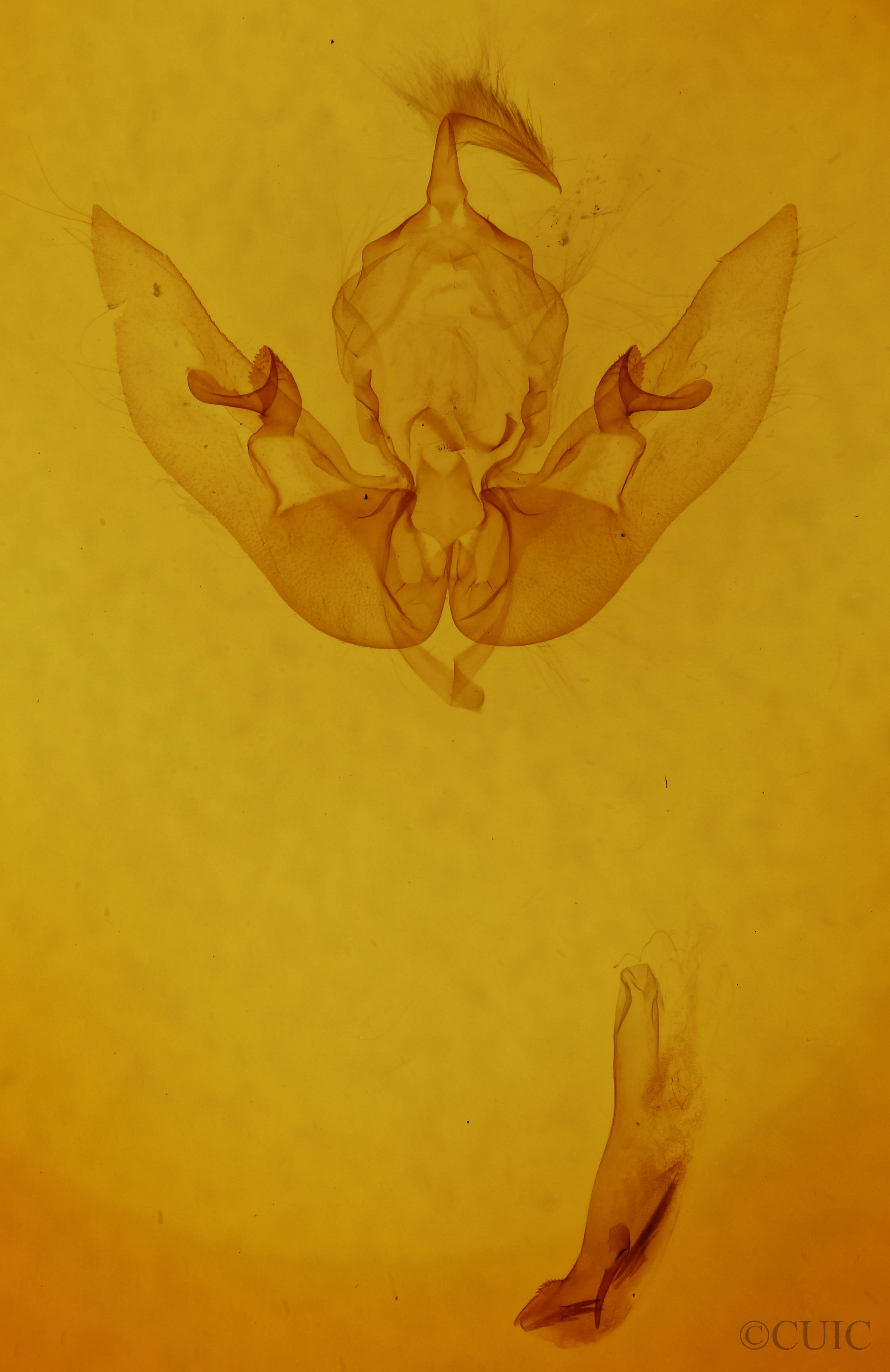 genitalia view of adult Sunira