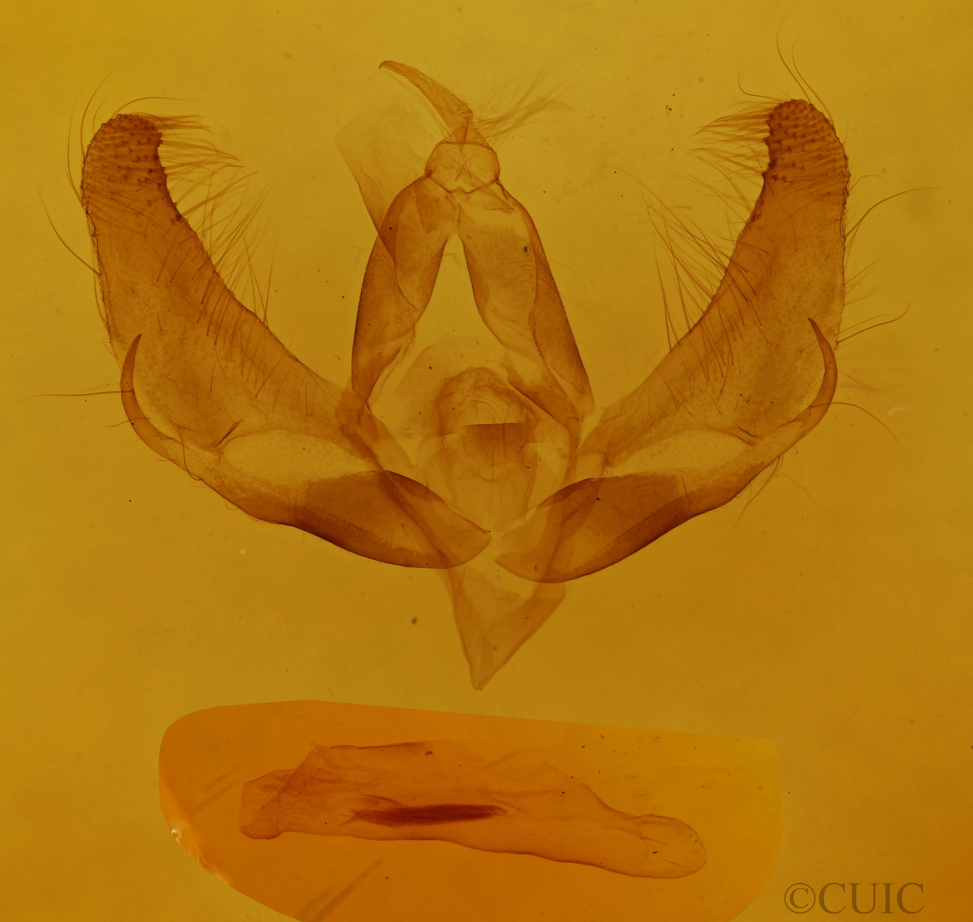 genitalia view of adult Trichosea ludifica