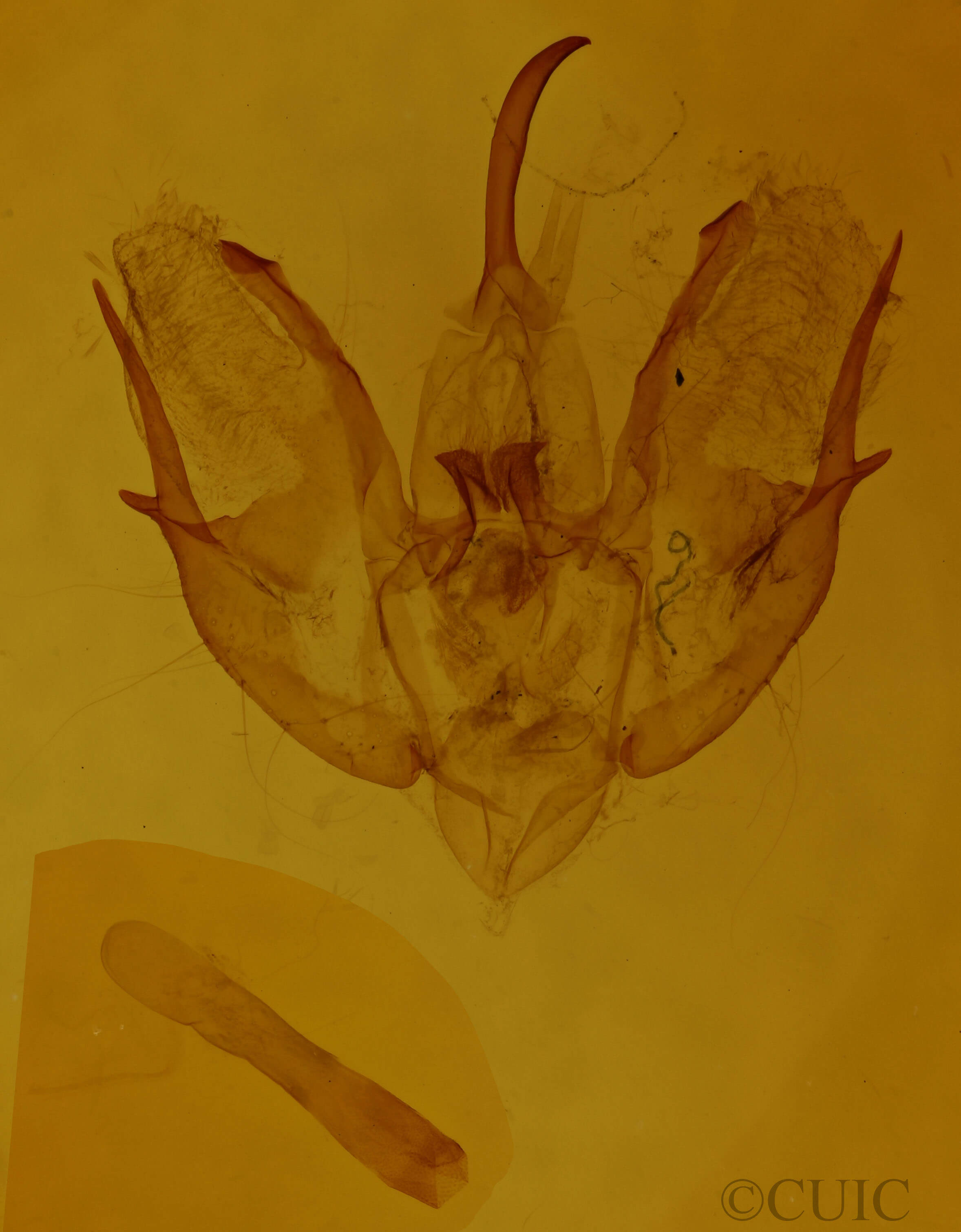 genitalia view of adult Triphosa dubitata