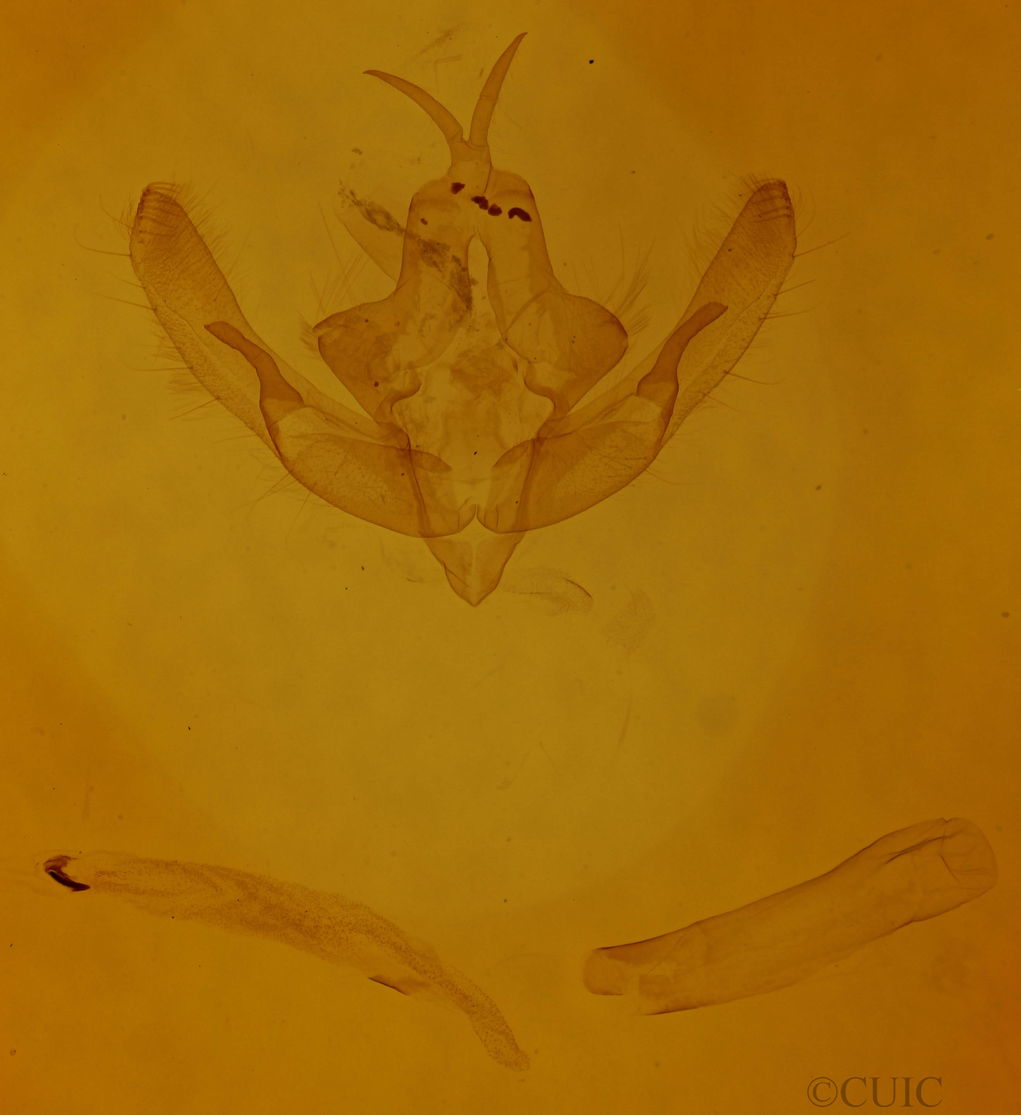 genitalia view of adult Xanthia togata