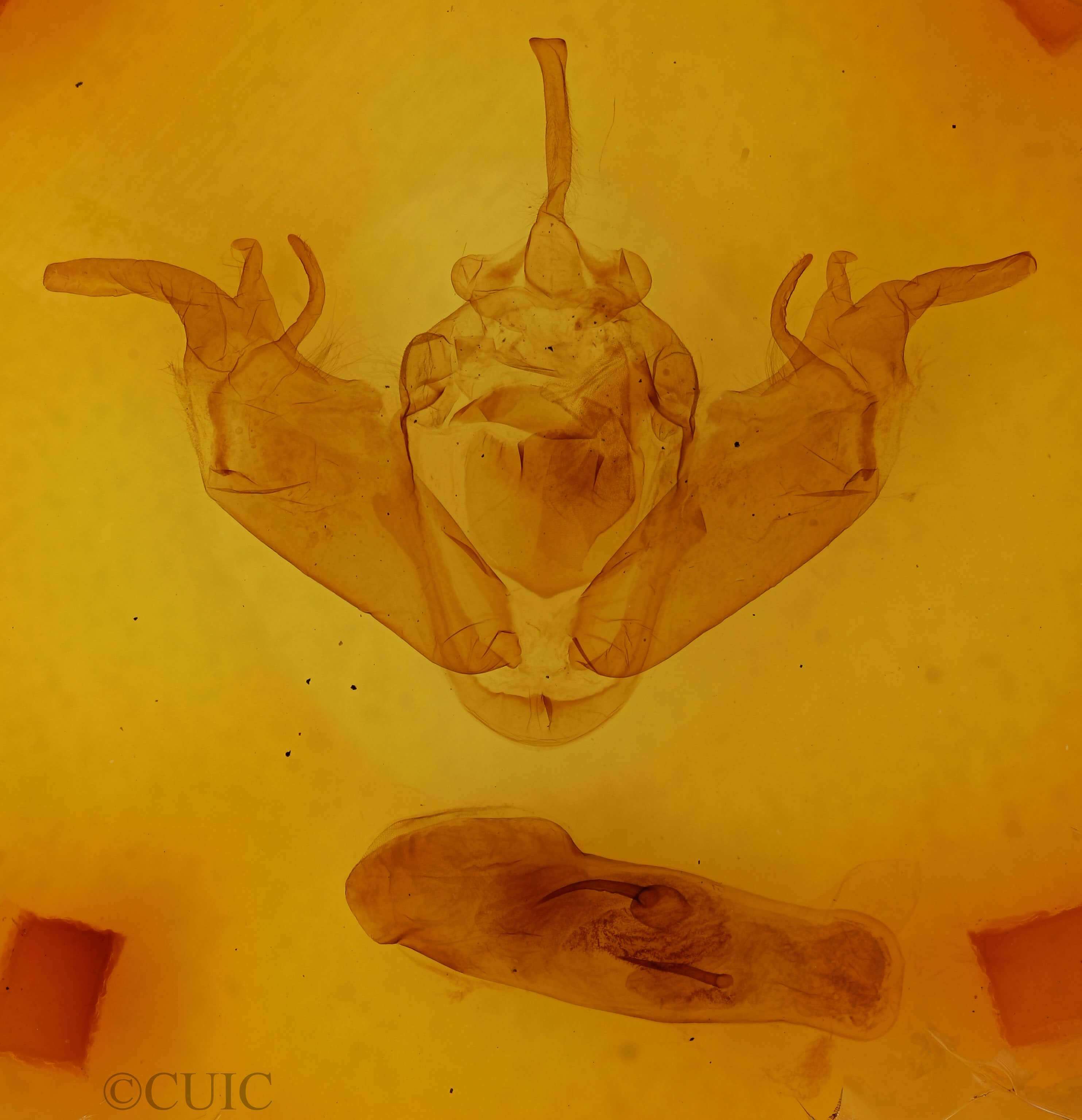 genitalia view of adult Xylena exsoleta