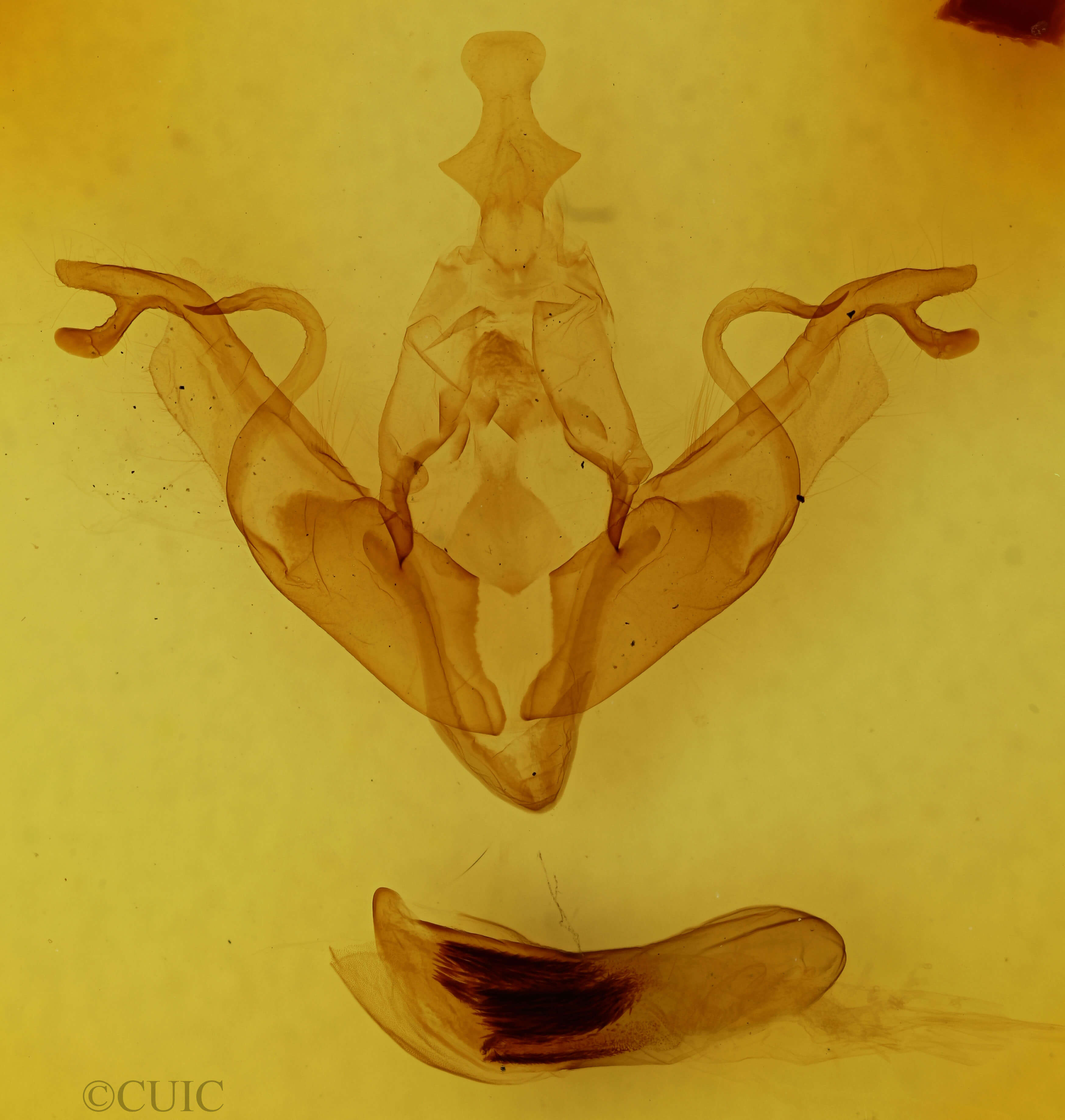 genitalia view of adult Xylena thoracica
