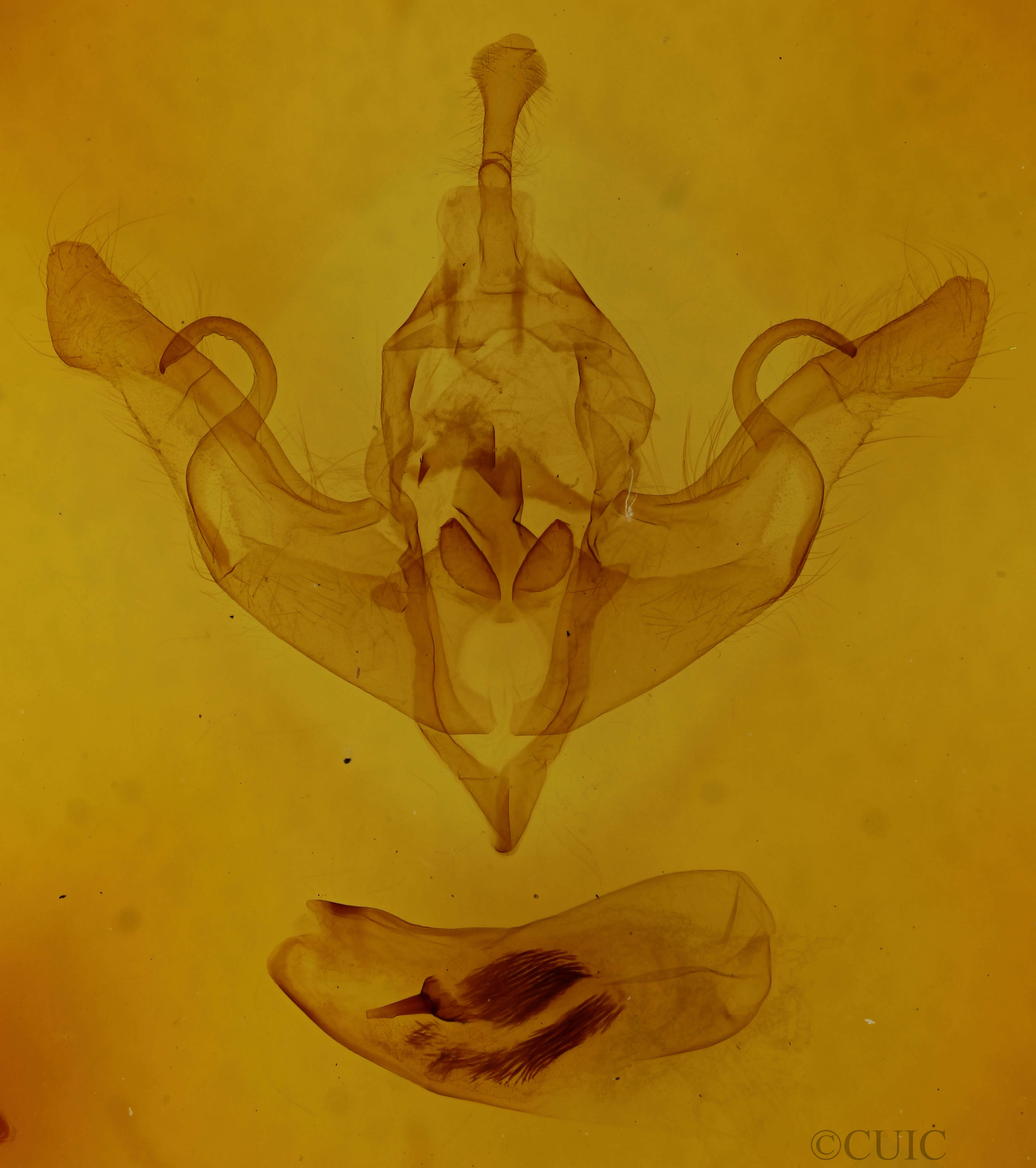 genitalia view of adult Xylena vestusta