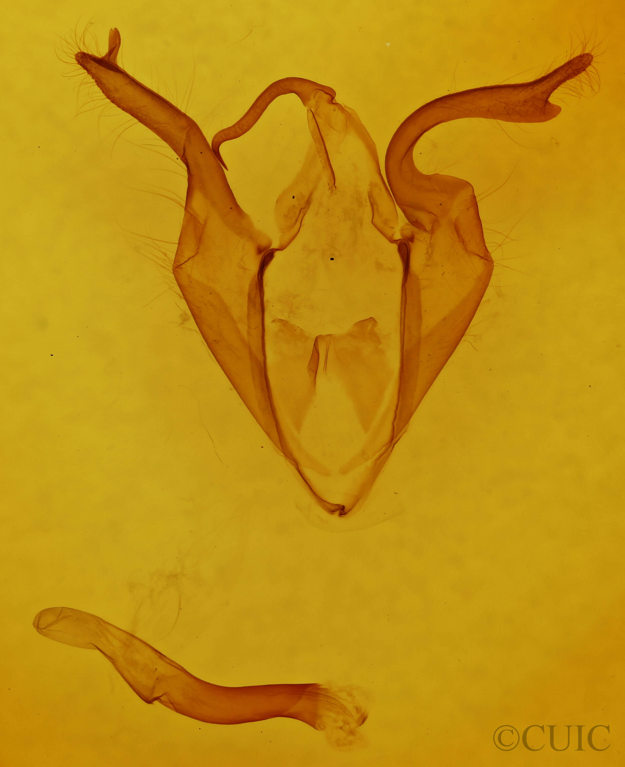 genitalia view of adult Zale galbanata
