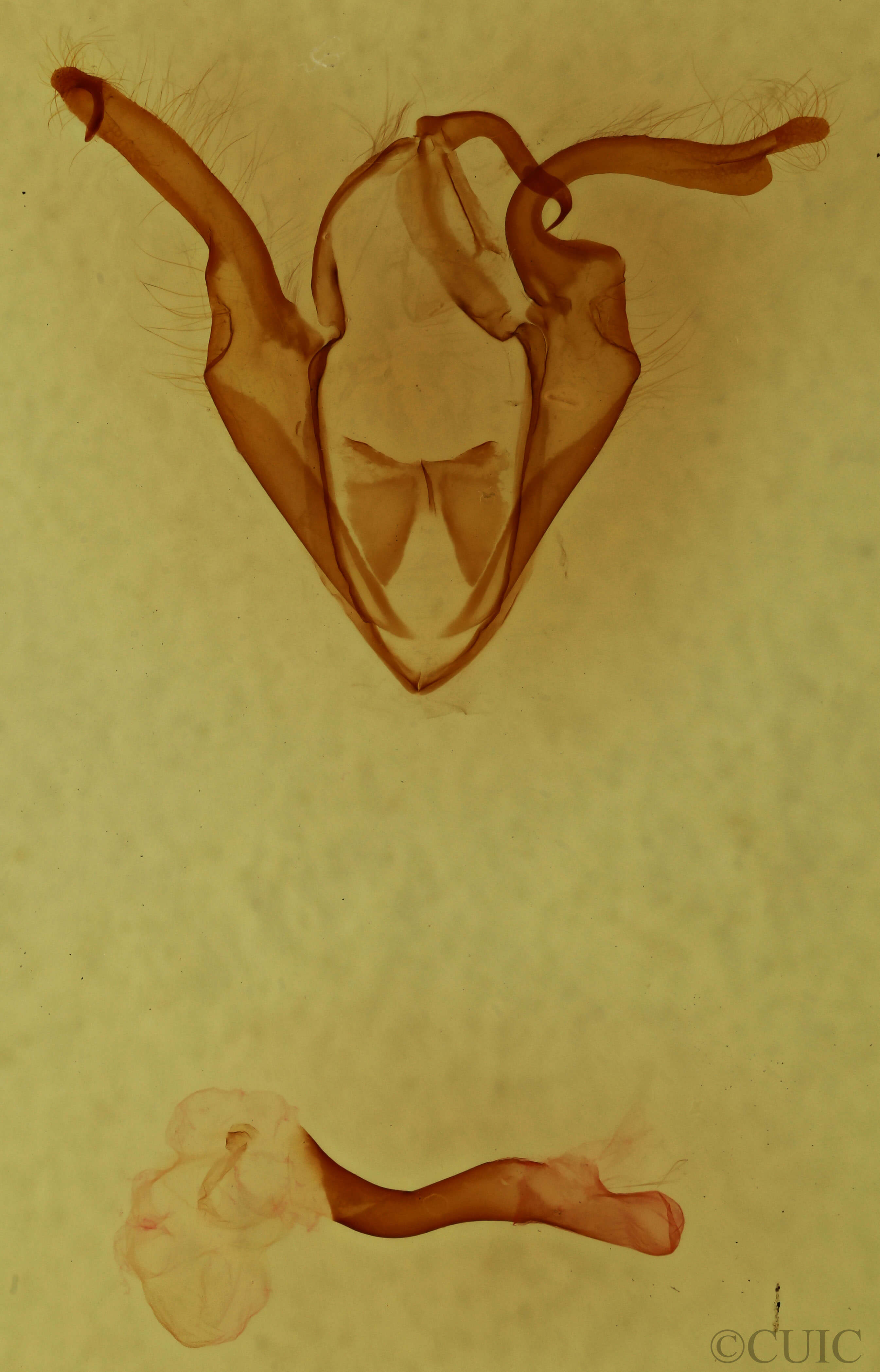 genitalia view of adult Zale galbanata