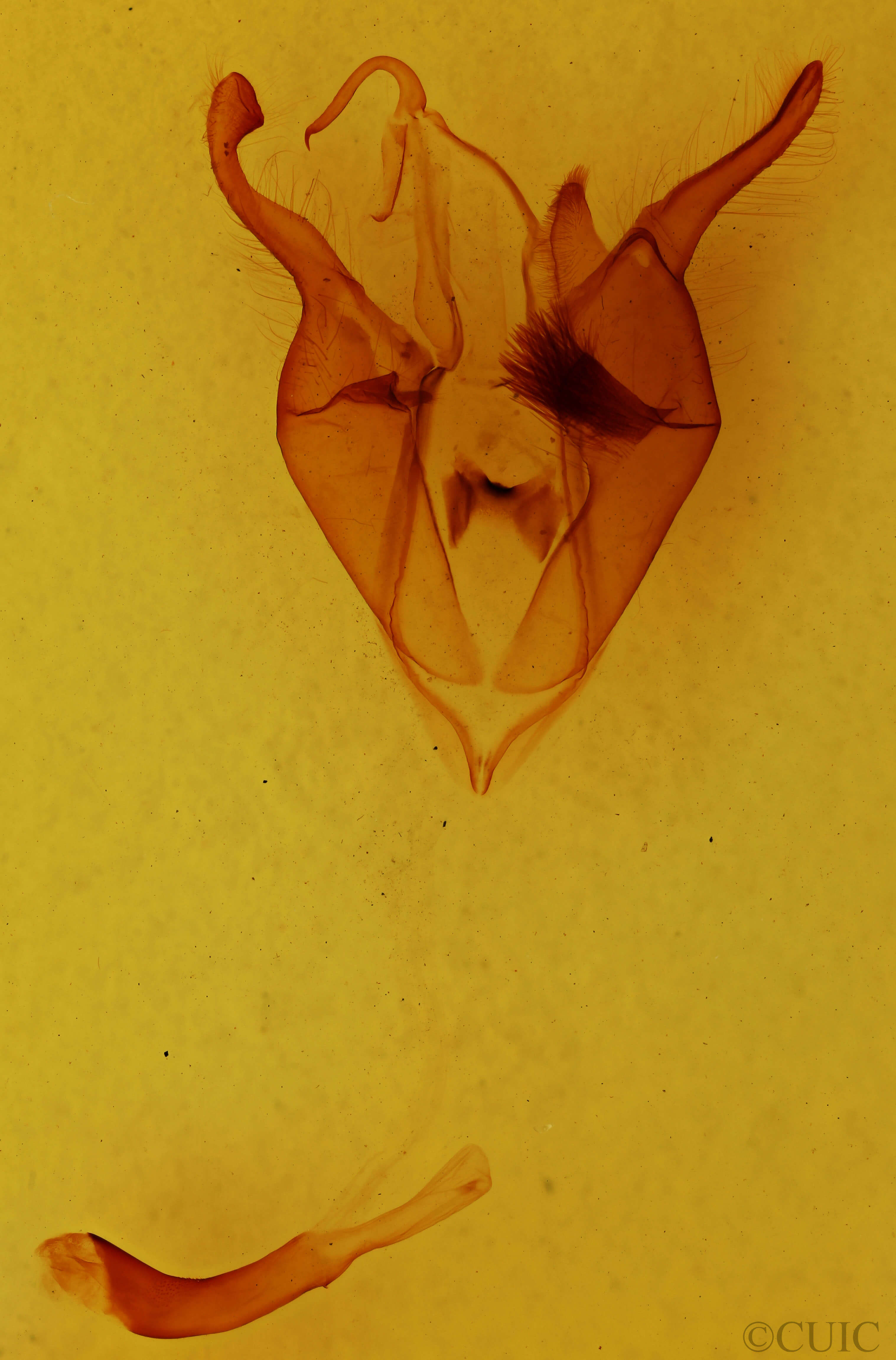 genitalia view of adult Zale metatoides