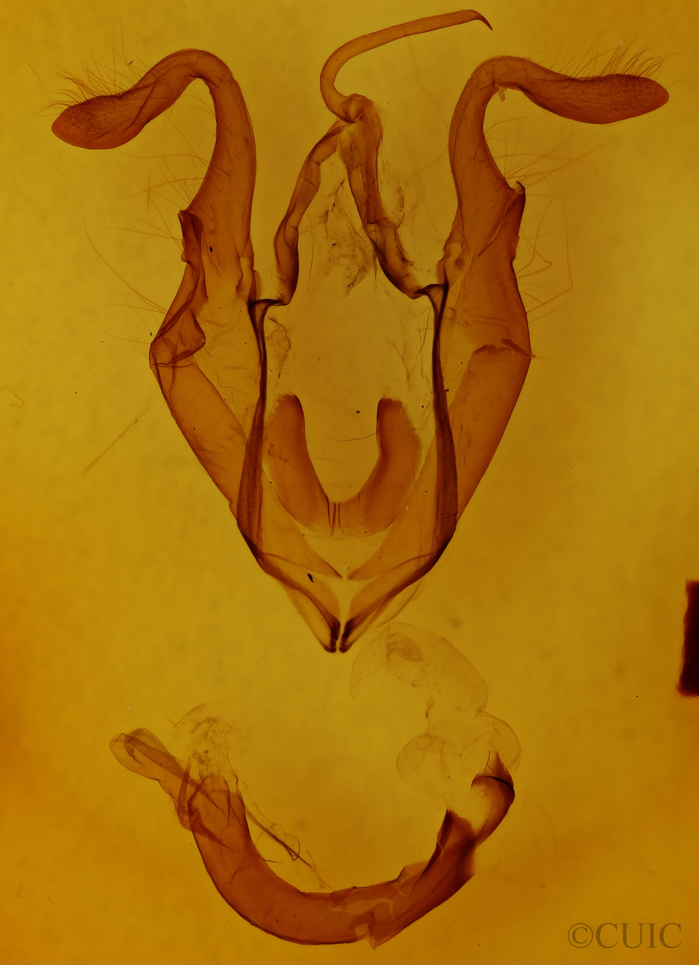 genitalia view of adult Zale unilineata