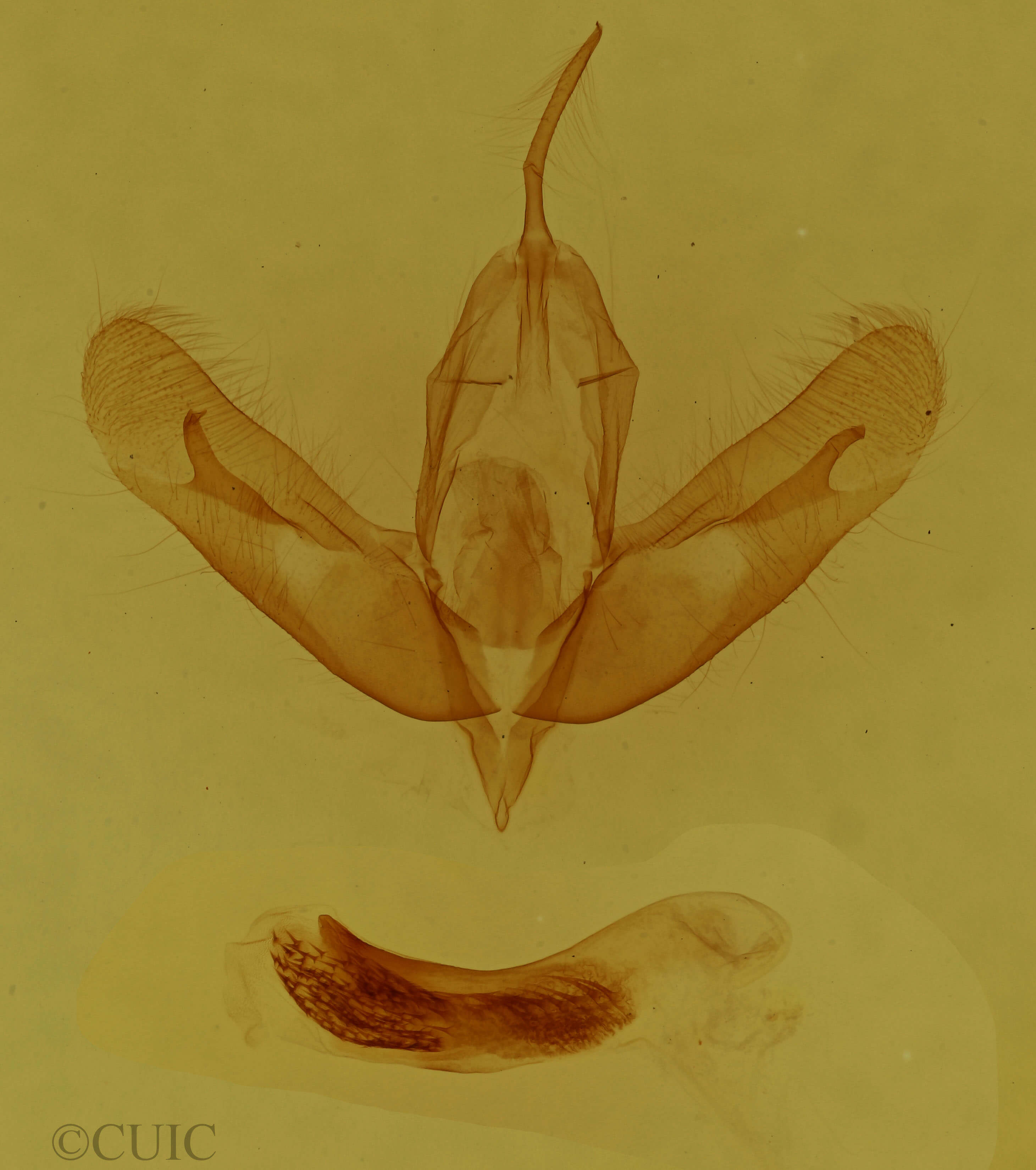 genitalia view of adult Acronicta albarufa