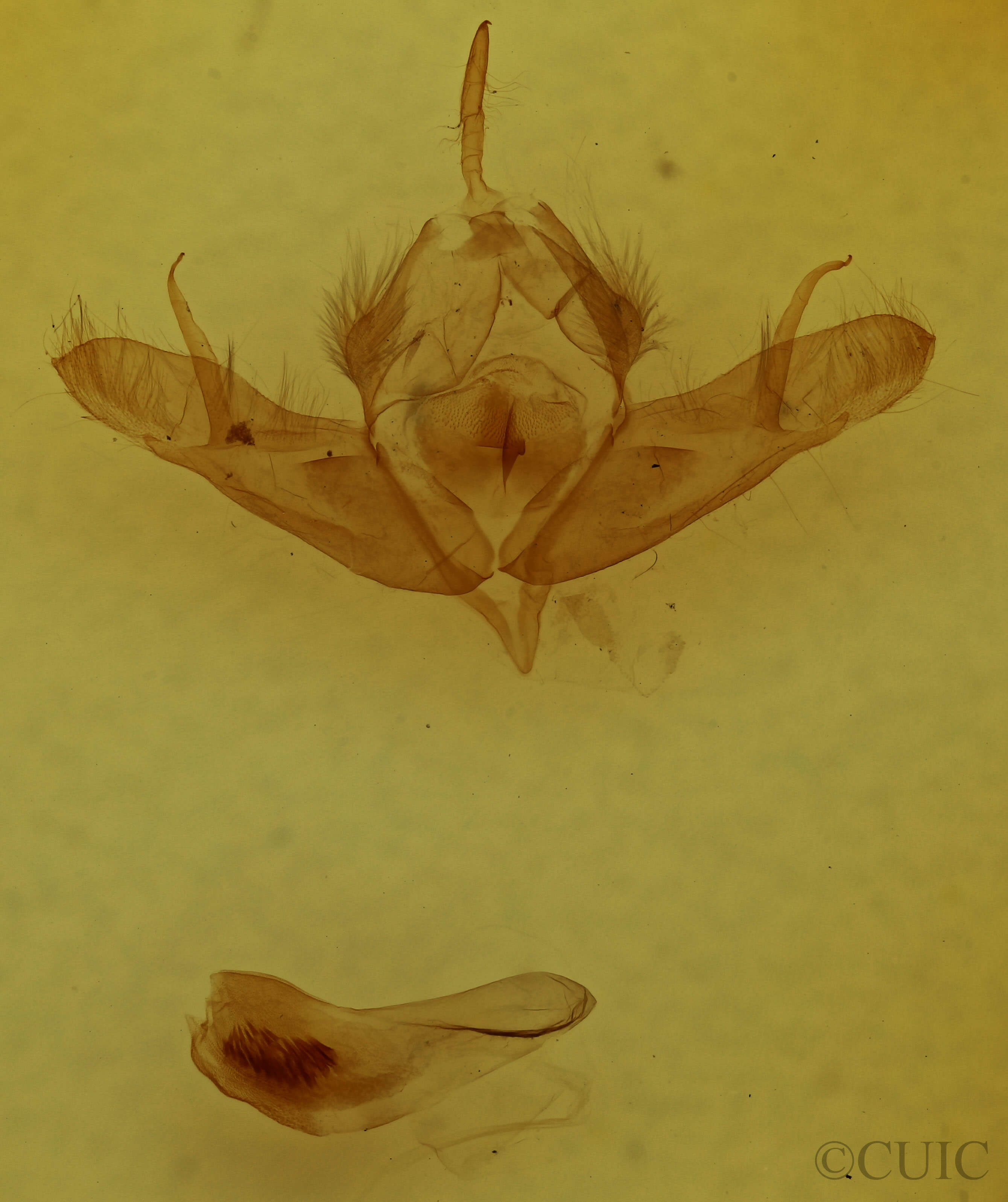 genitalia view of adult Acronicta oblinita