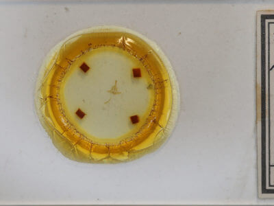 slide view of adult Amolita roseola