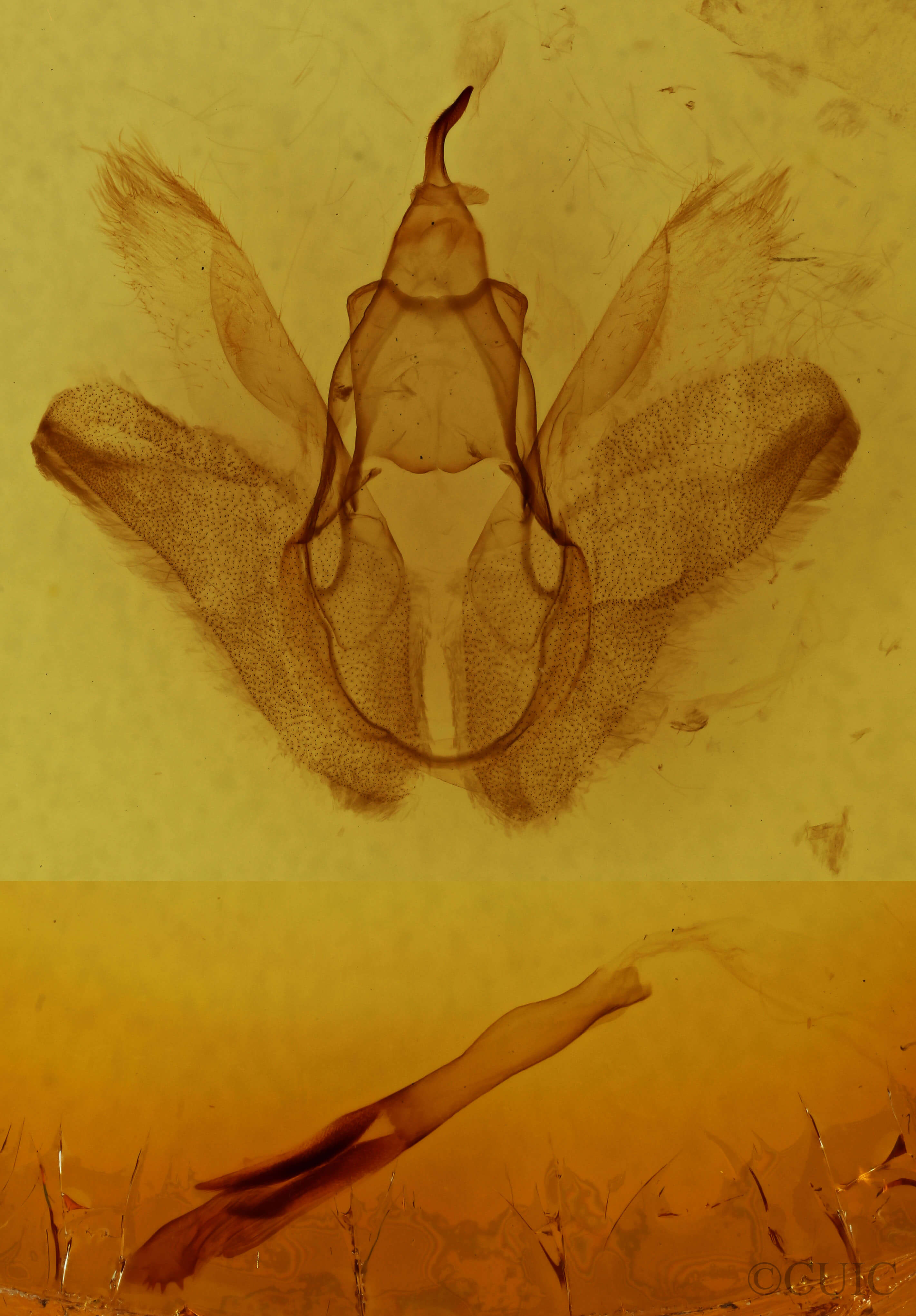 genitalia view of adult Anomis fulvida