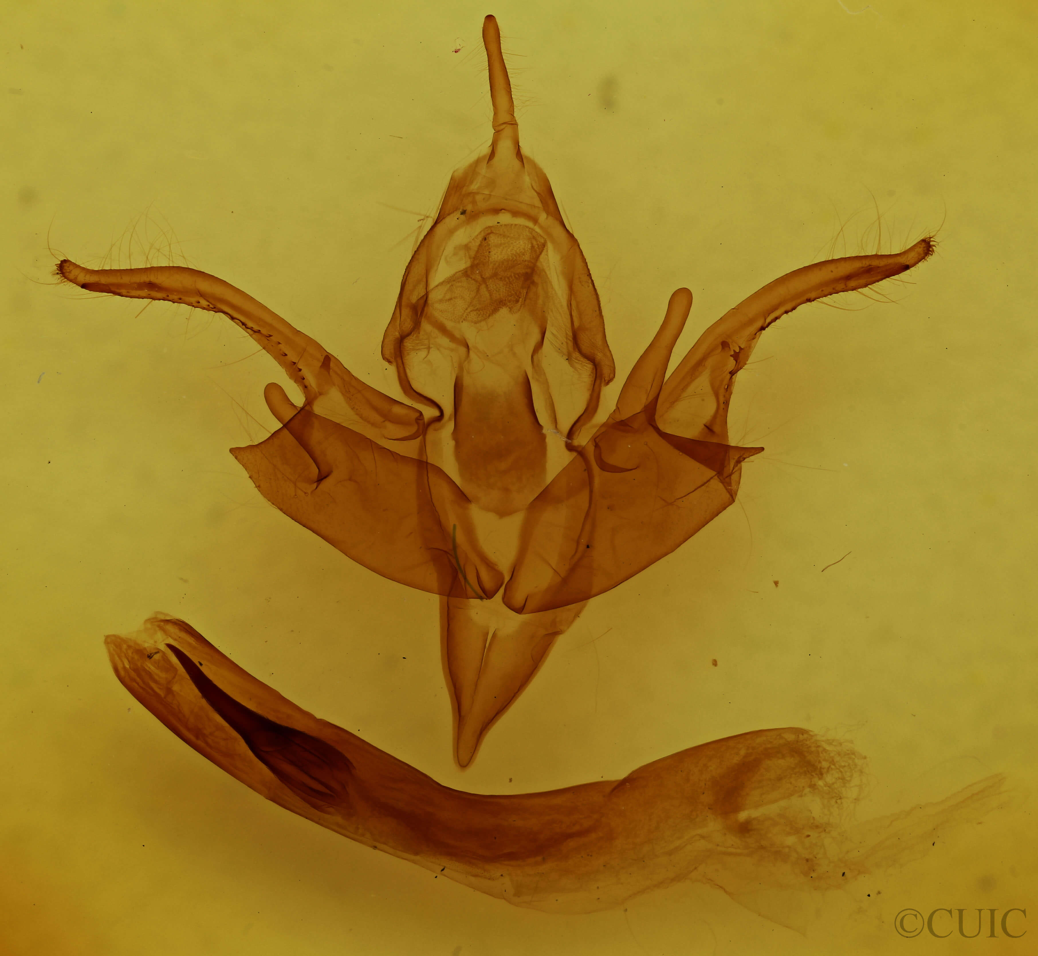 genitalia view of adult Chaetaglaea tremula