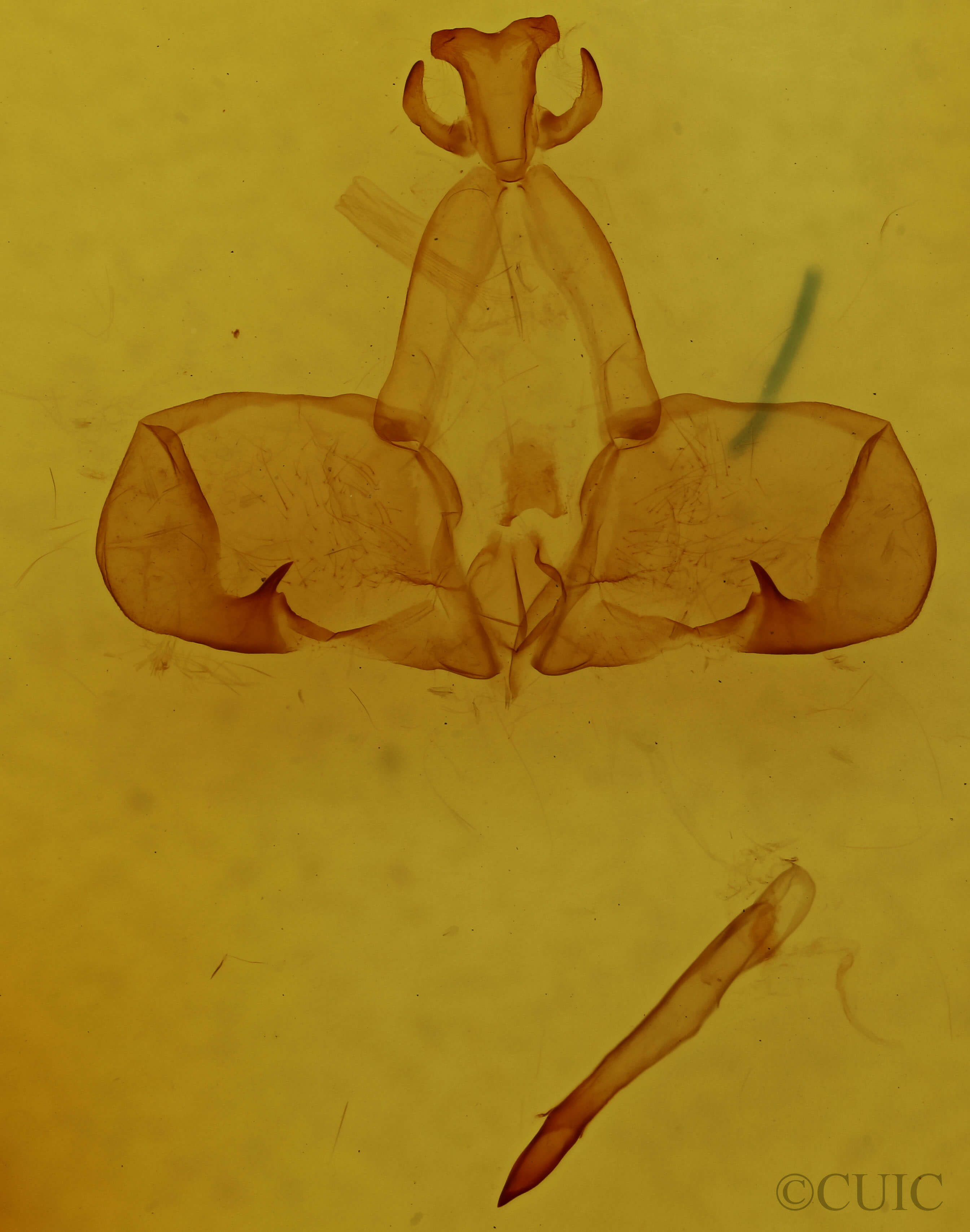 genitalia view of adult Dognina veltini