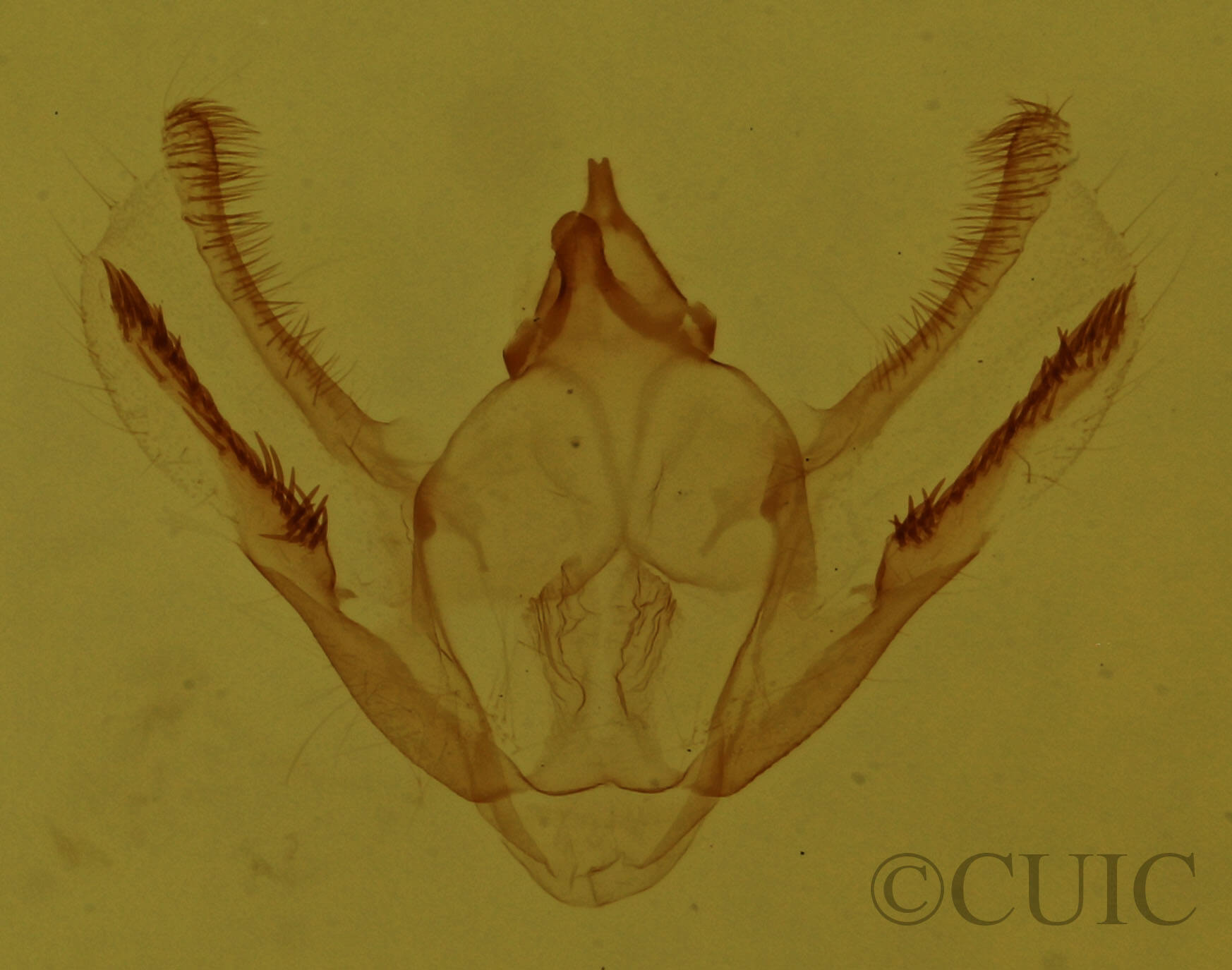 genitalia view of adult Glena cognataria
