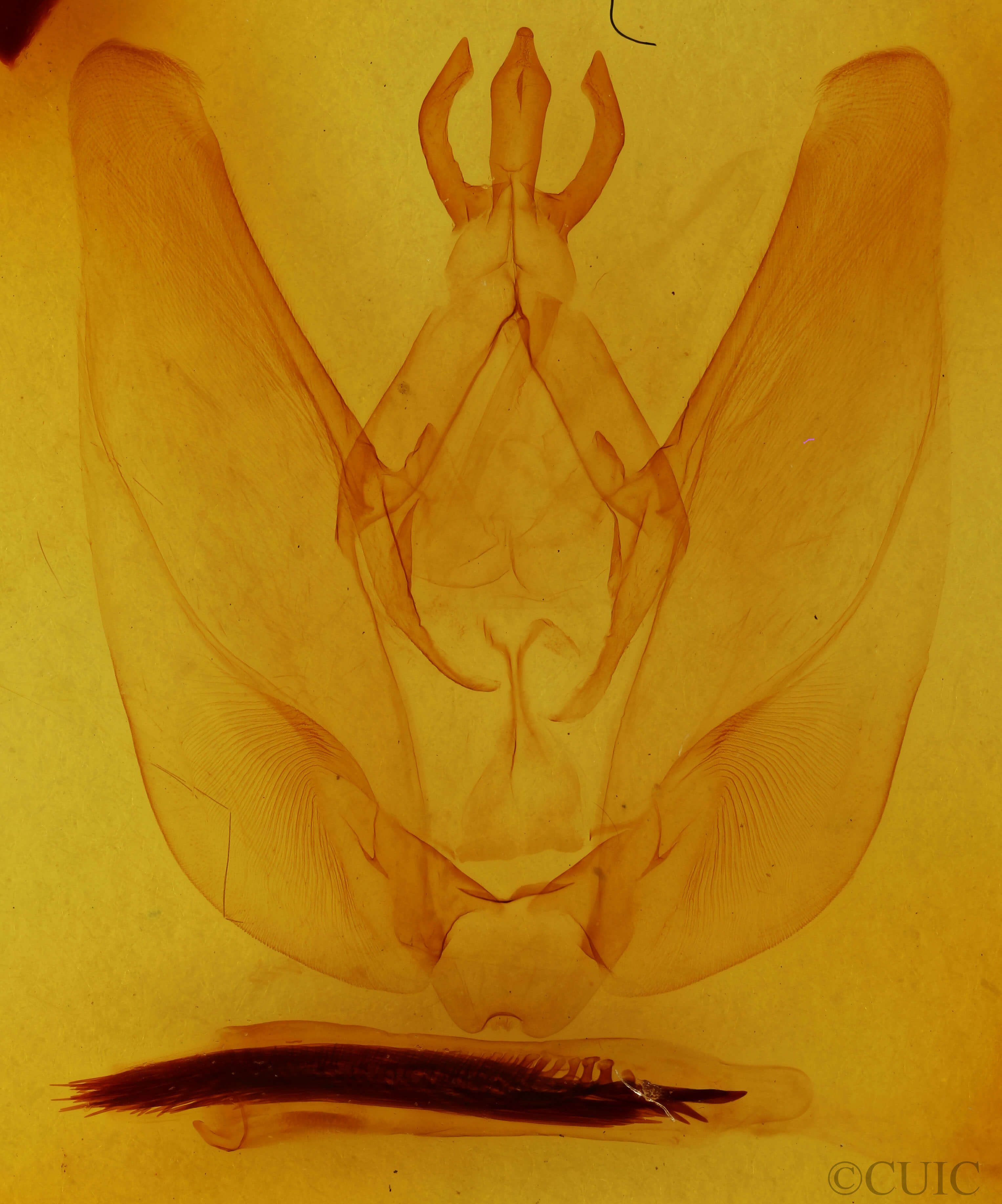 genitalia view of adult Hapigia simplex
