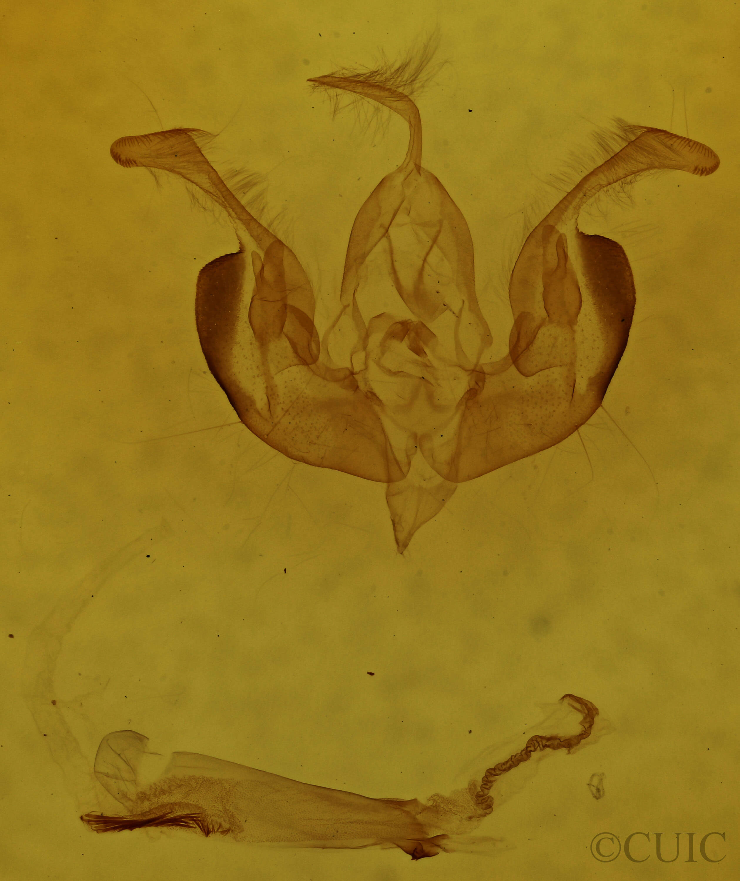 genitalia view of adult Lacinipolia strigicollis