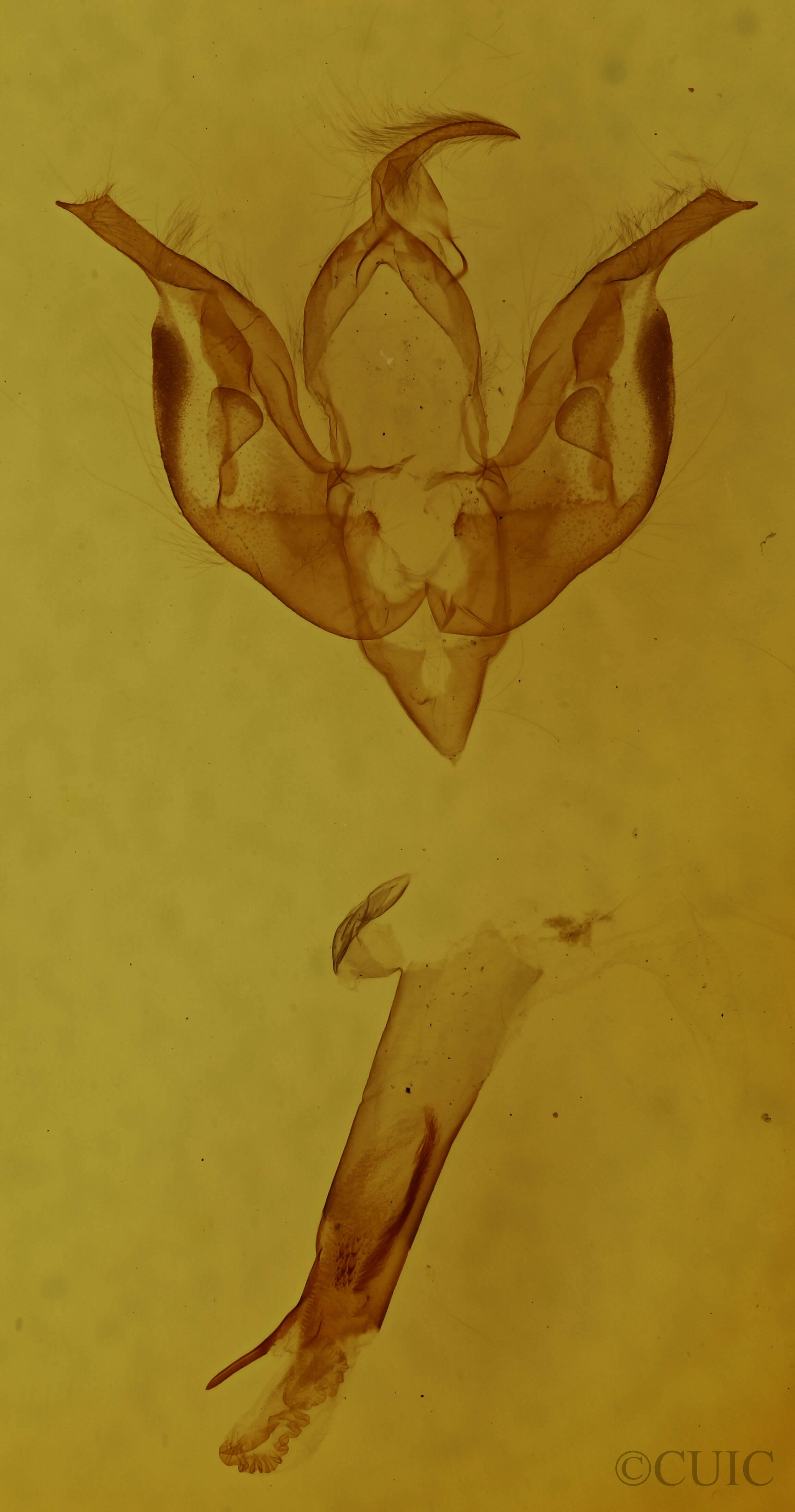 genitalia view of adult Lacinipolia strigicollis