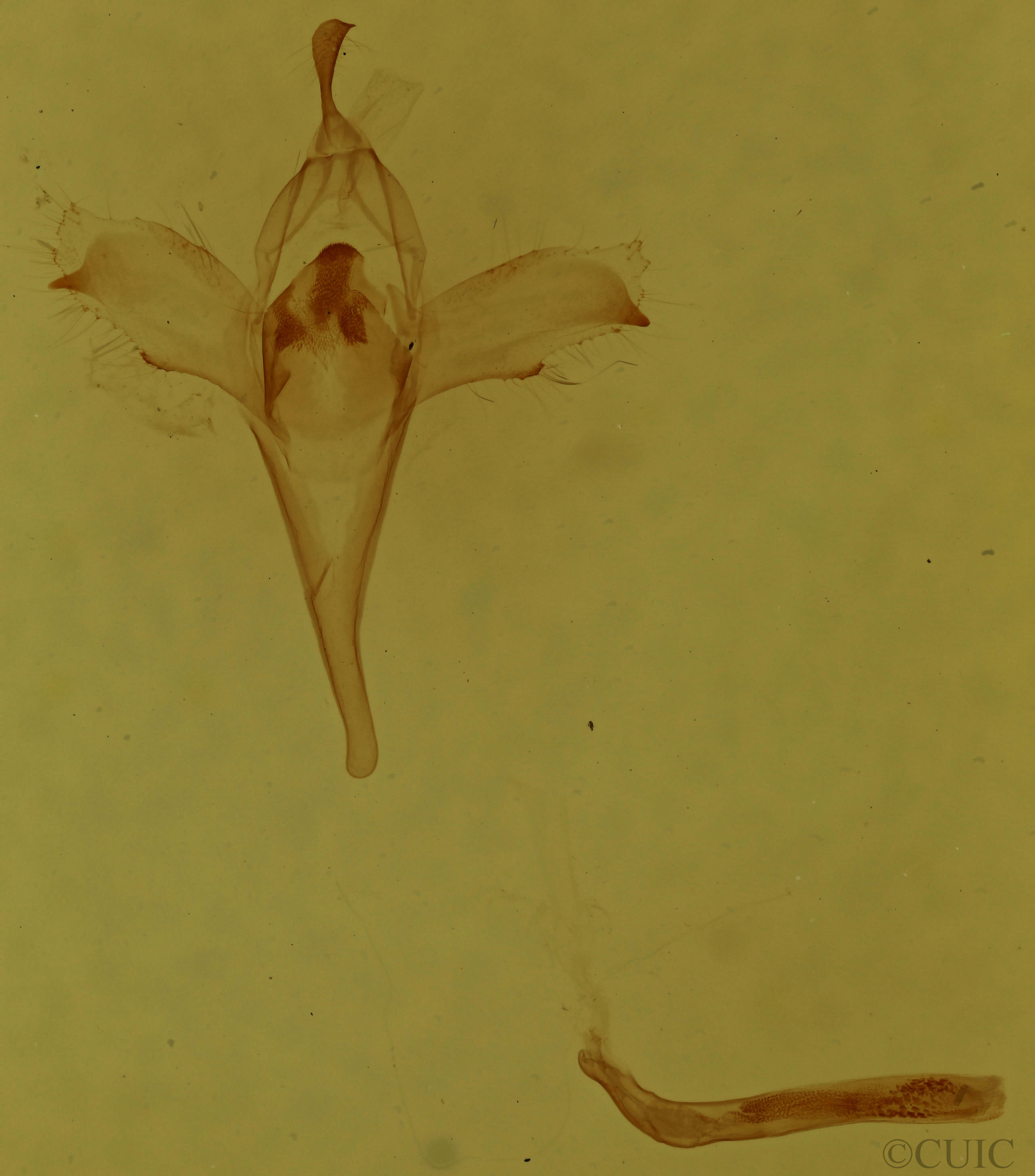 genitalia view of adult Macrochilo orciferalis