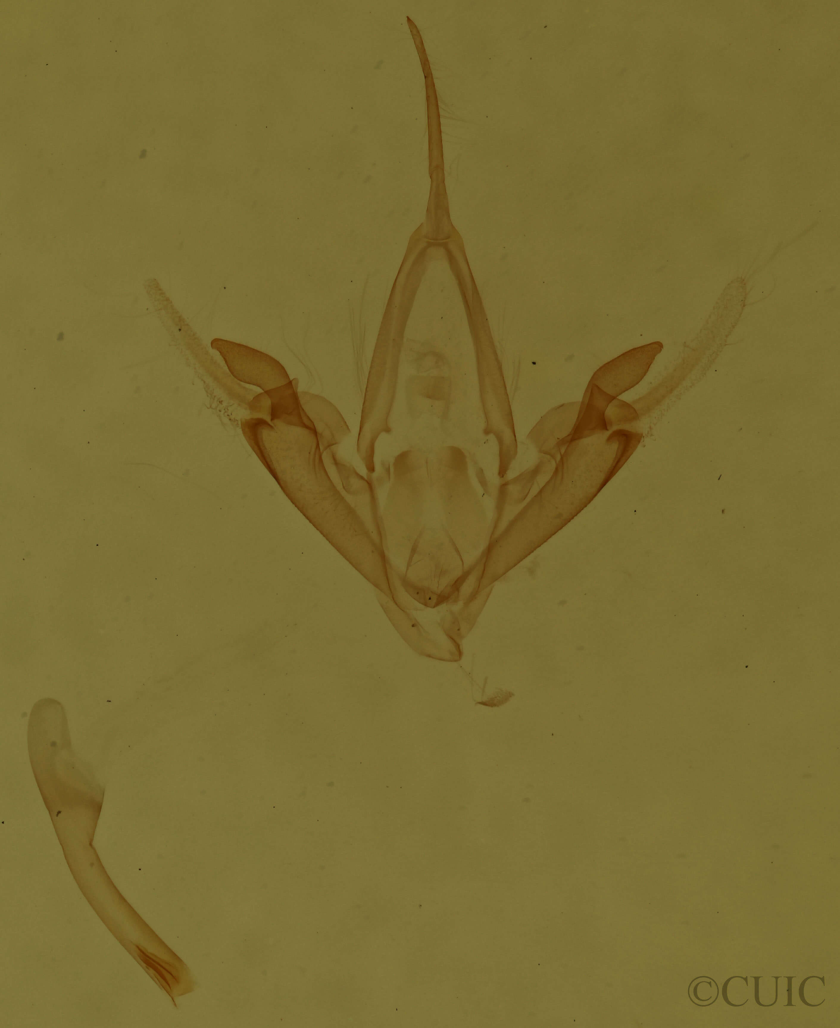 genitalia view of adult Metalectra tantillus