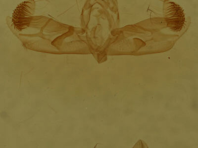 genitalia view of adult Micrathetis