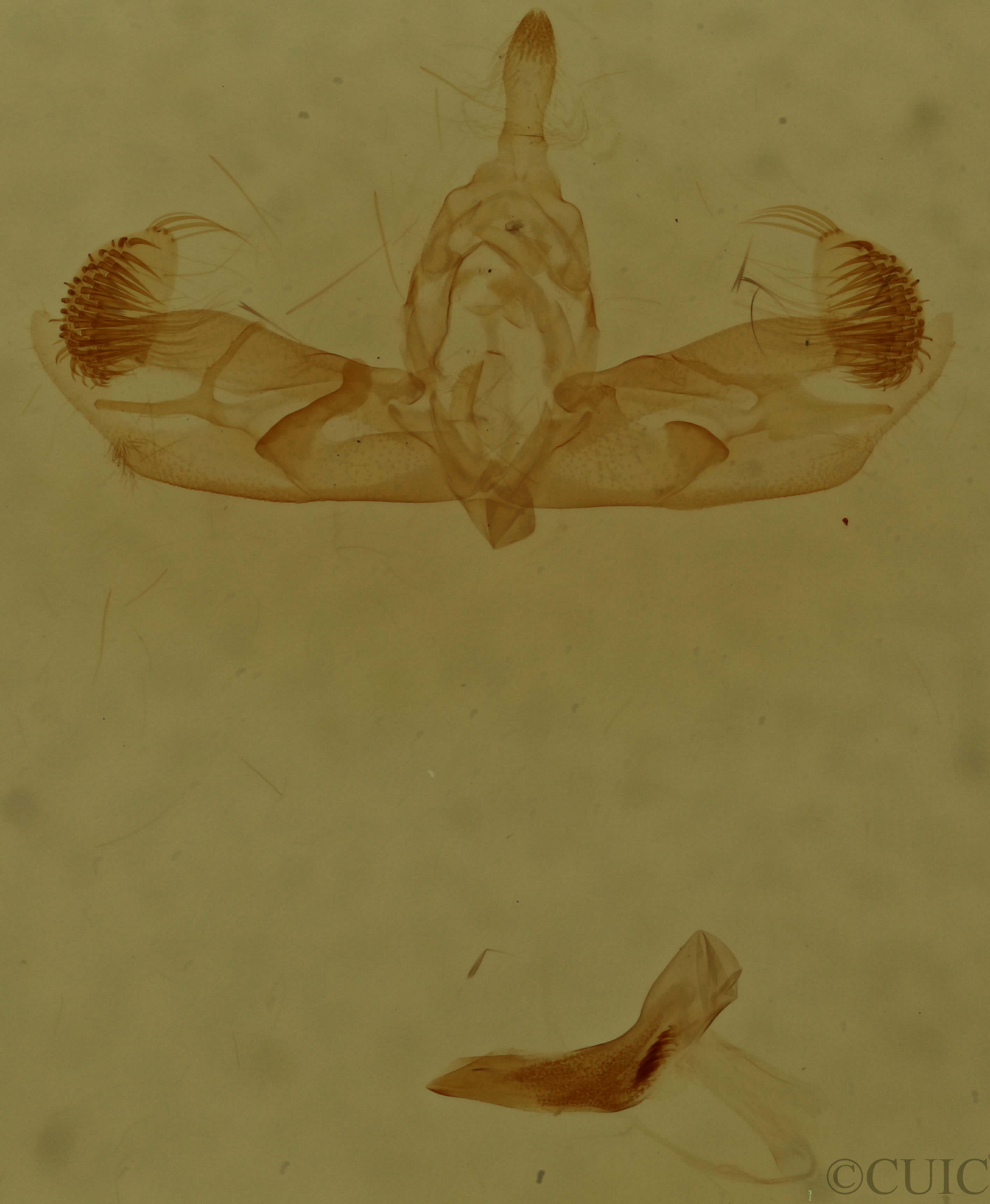 genitalia view of adult Micrathetis