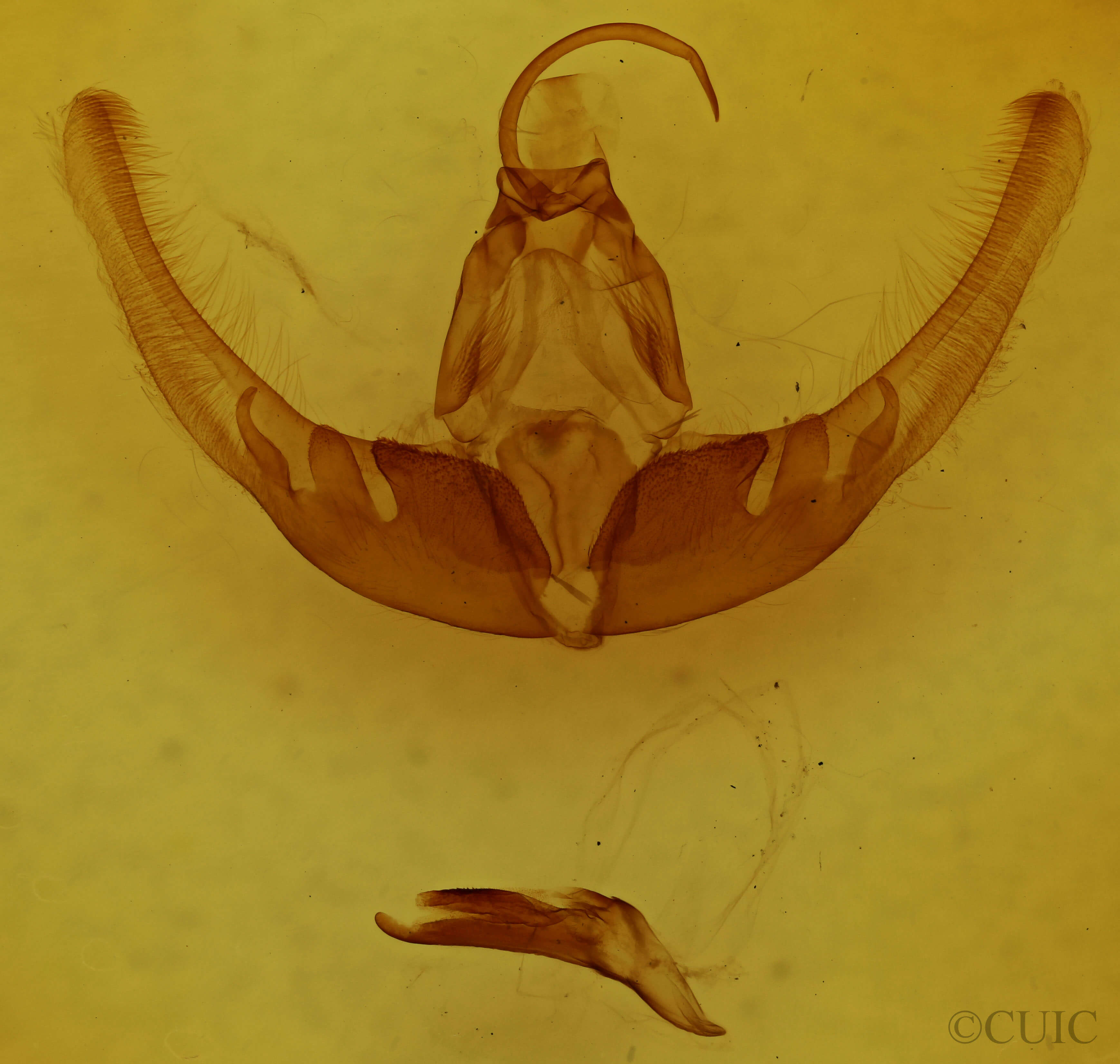 genitalia view of adult Condica imitata