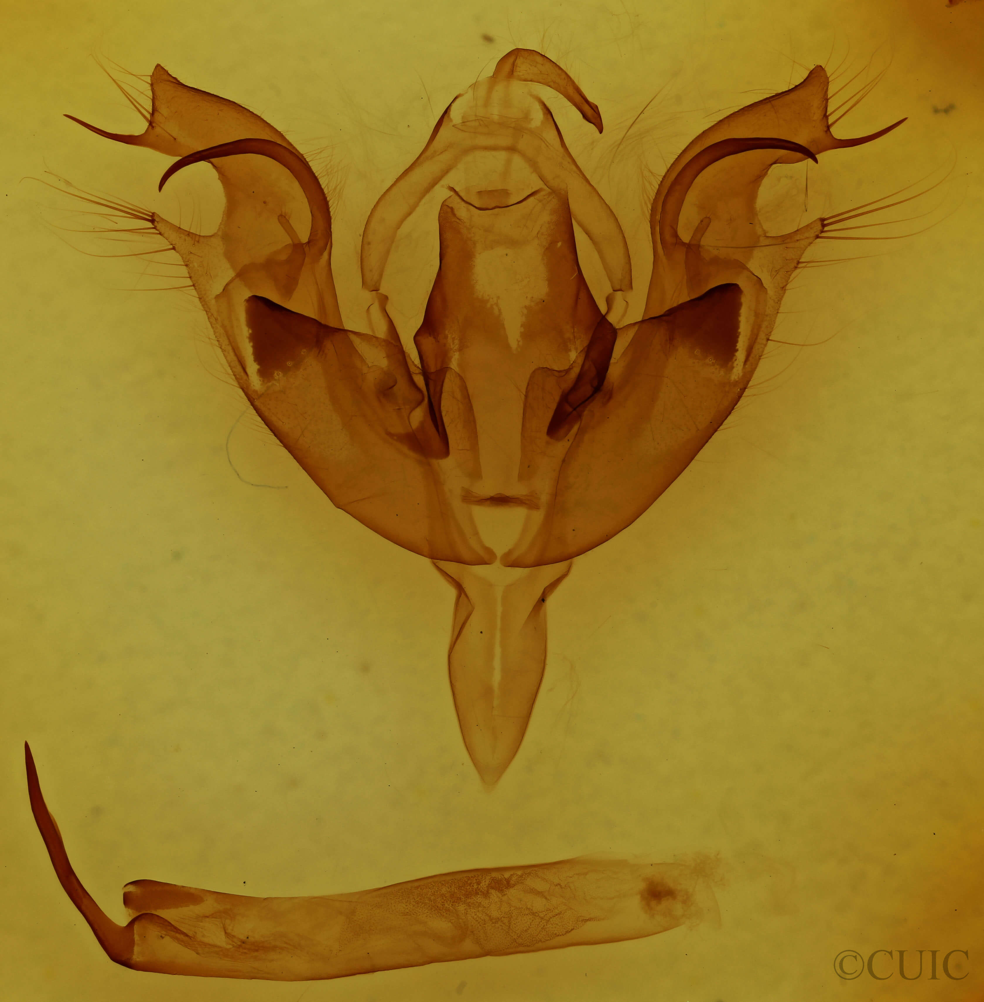 genitalia view of adult Orthosia hibisci