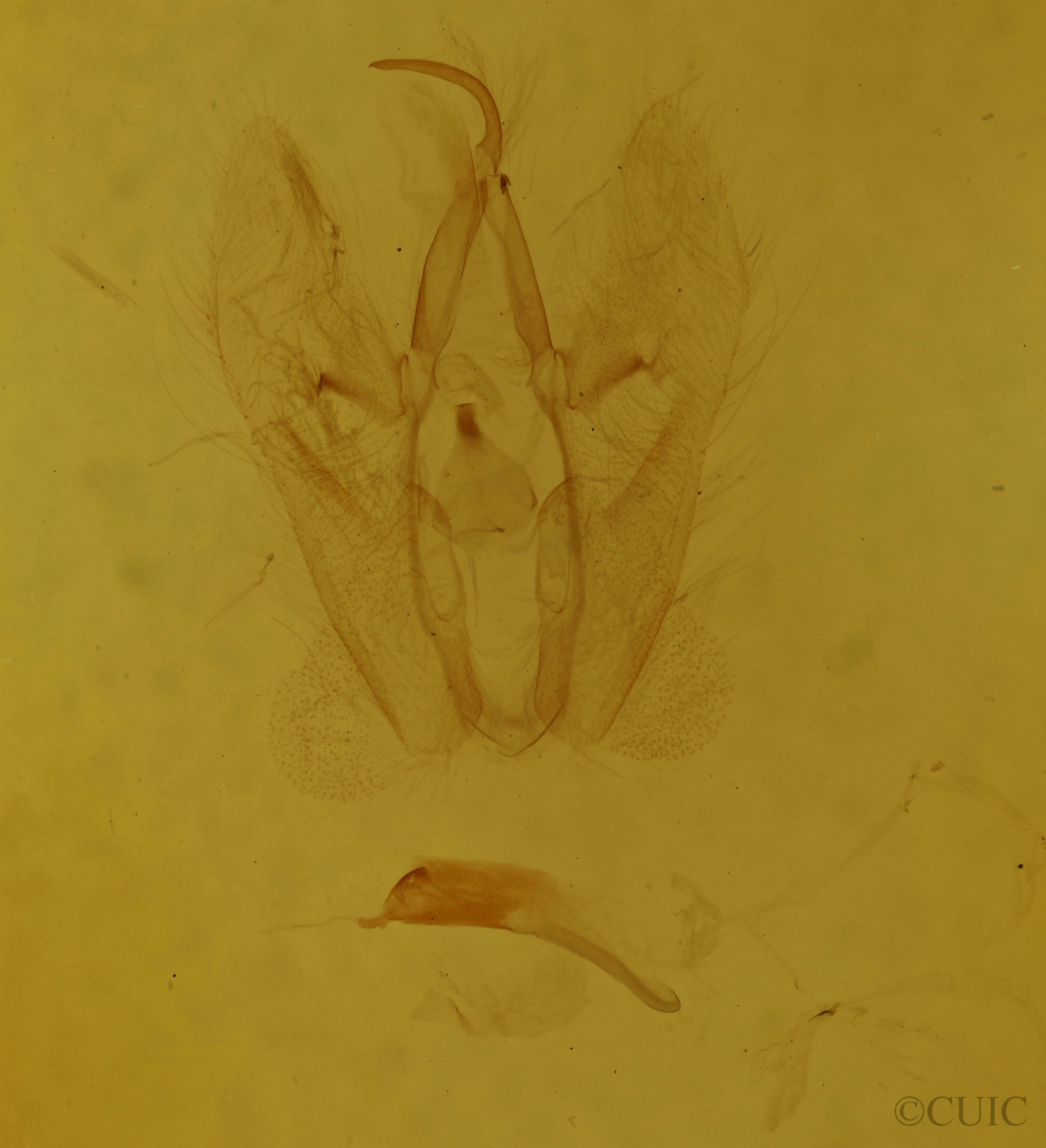 genitalia view of adult Perigea