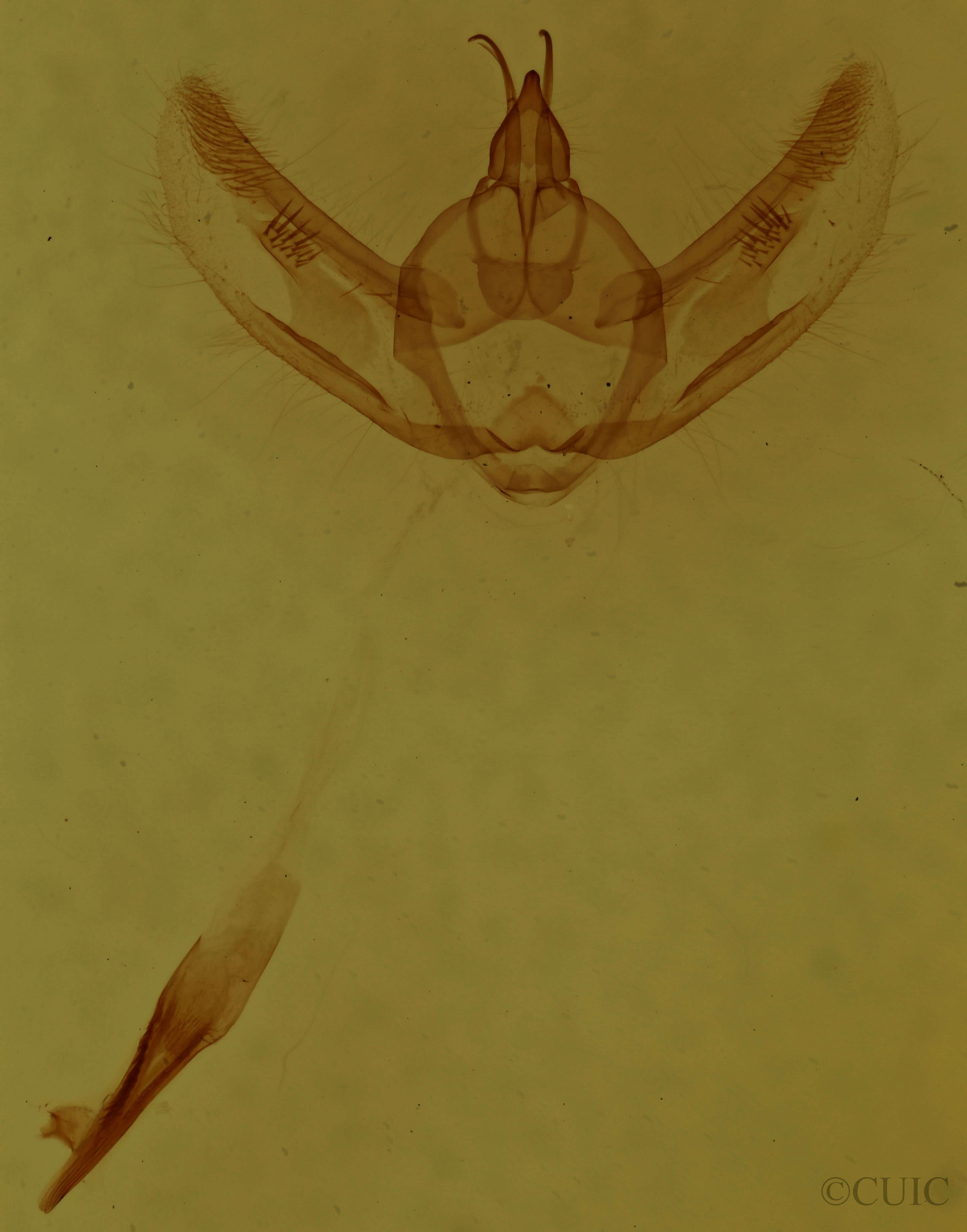 genitalia view of adult Hypomecis umbrosaria