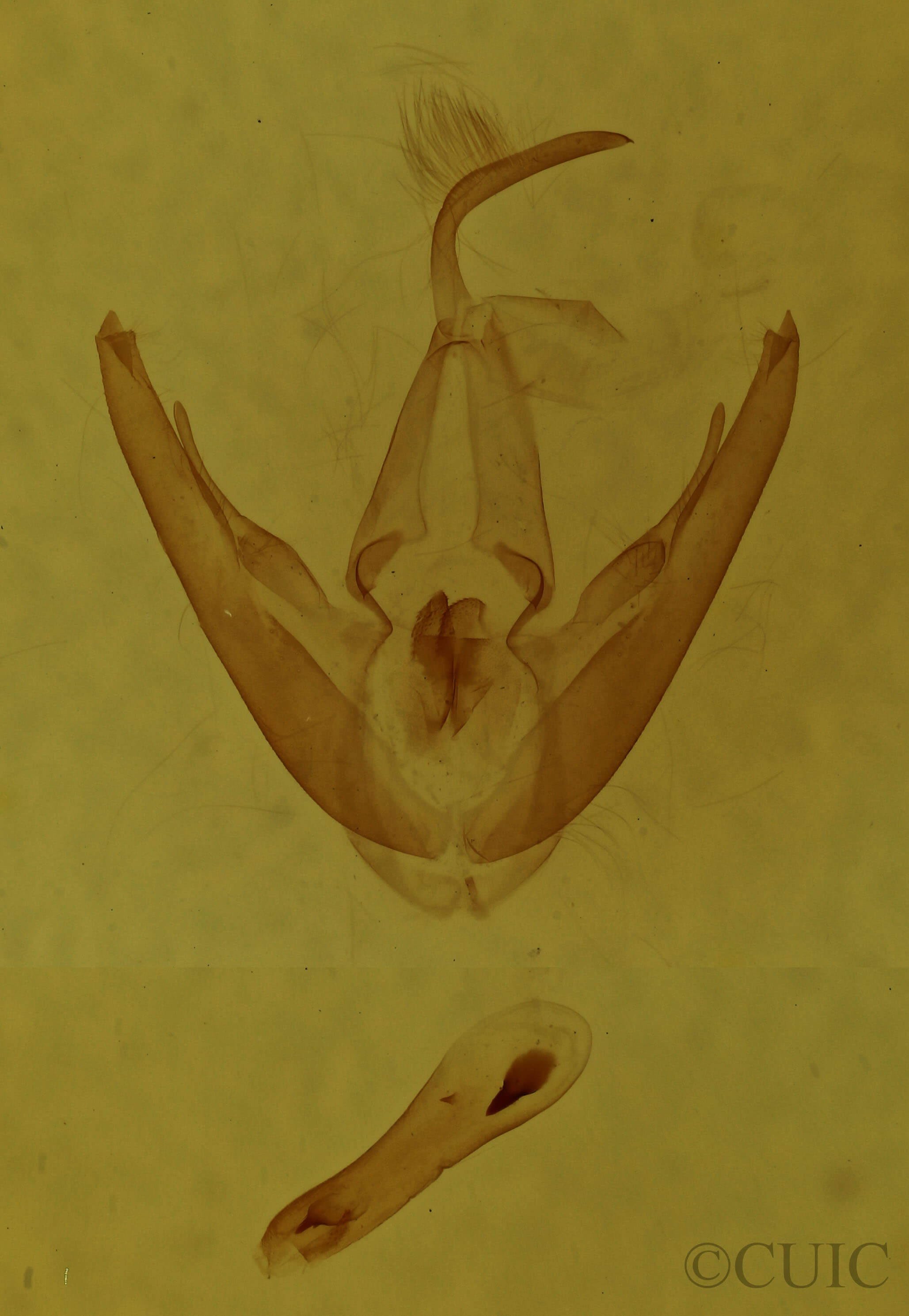 genitalia view of adult Rhododactyla semirosea