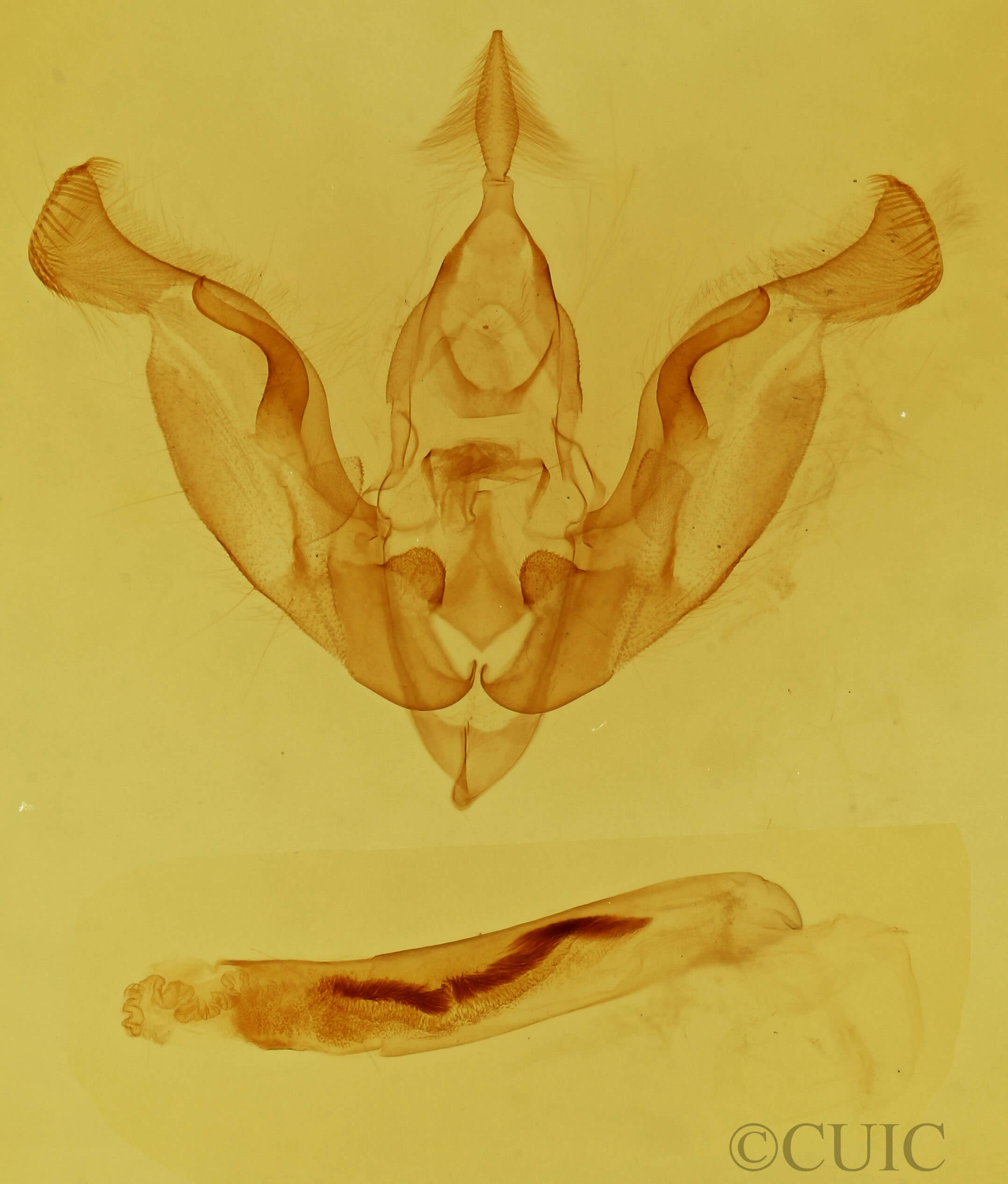 genitalia view of adult Trichocerapoda comstocki