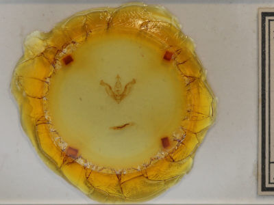 slide view of adult Trichocerapoda comstocki