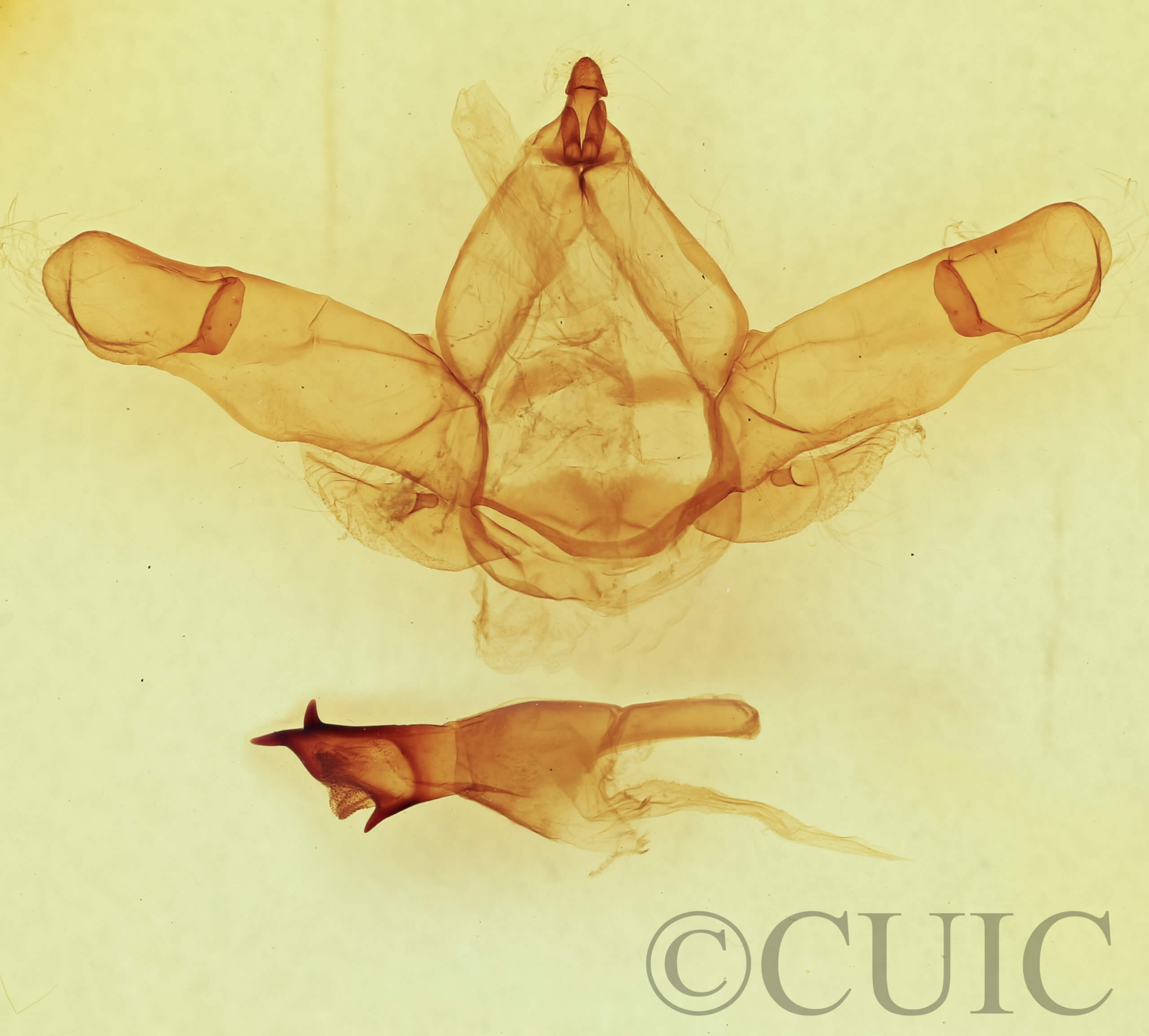 genitalia view of adult Nadata gibbosa