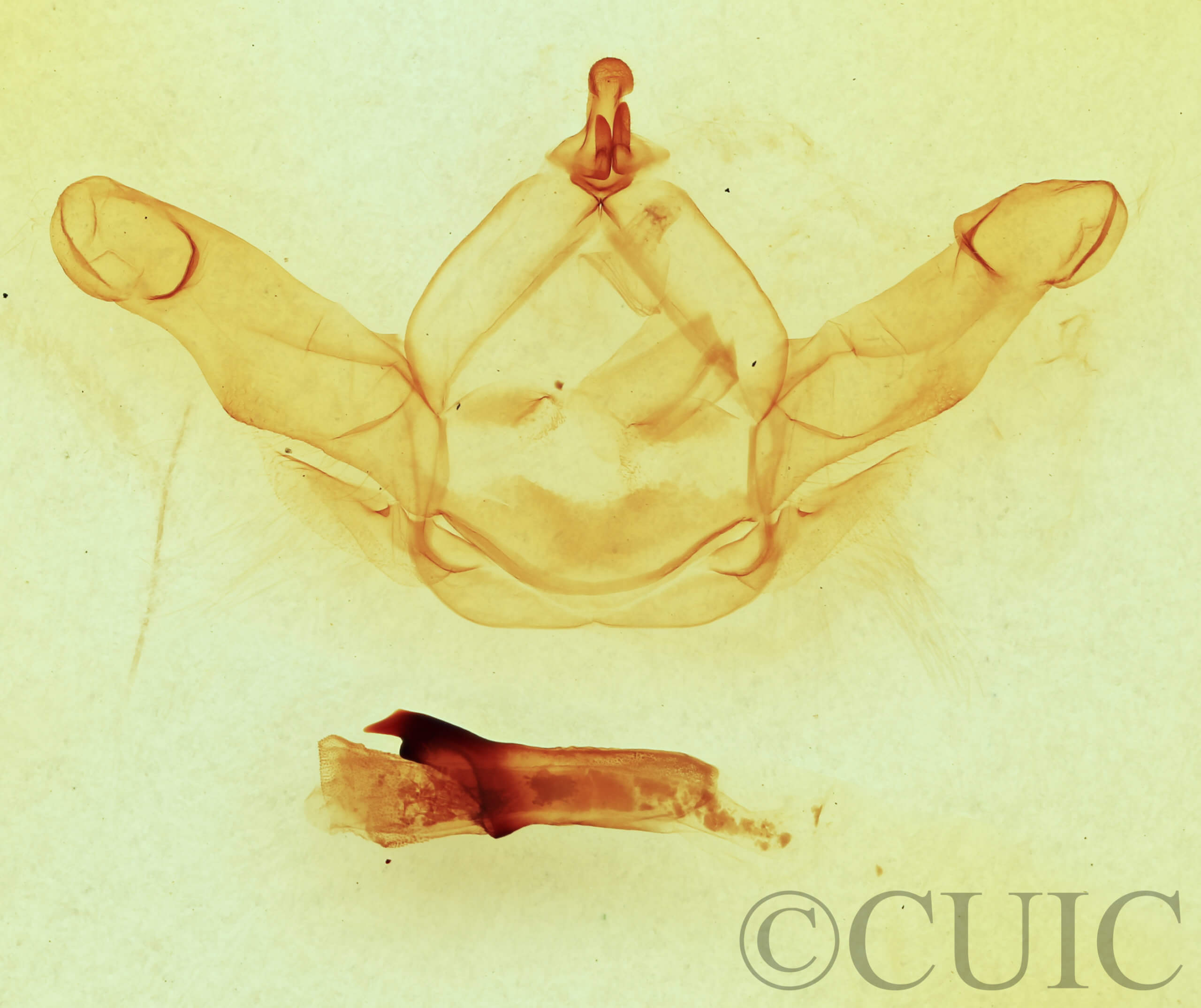 genitalia view of adult Nadata gibbosa