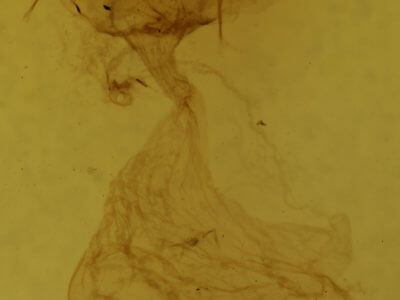 genitalia view of adult Acronicta haesitata