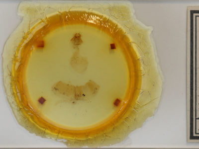 slide view of adult Acronicta haesitata