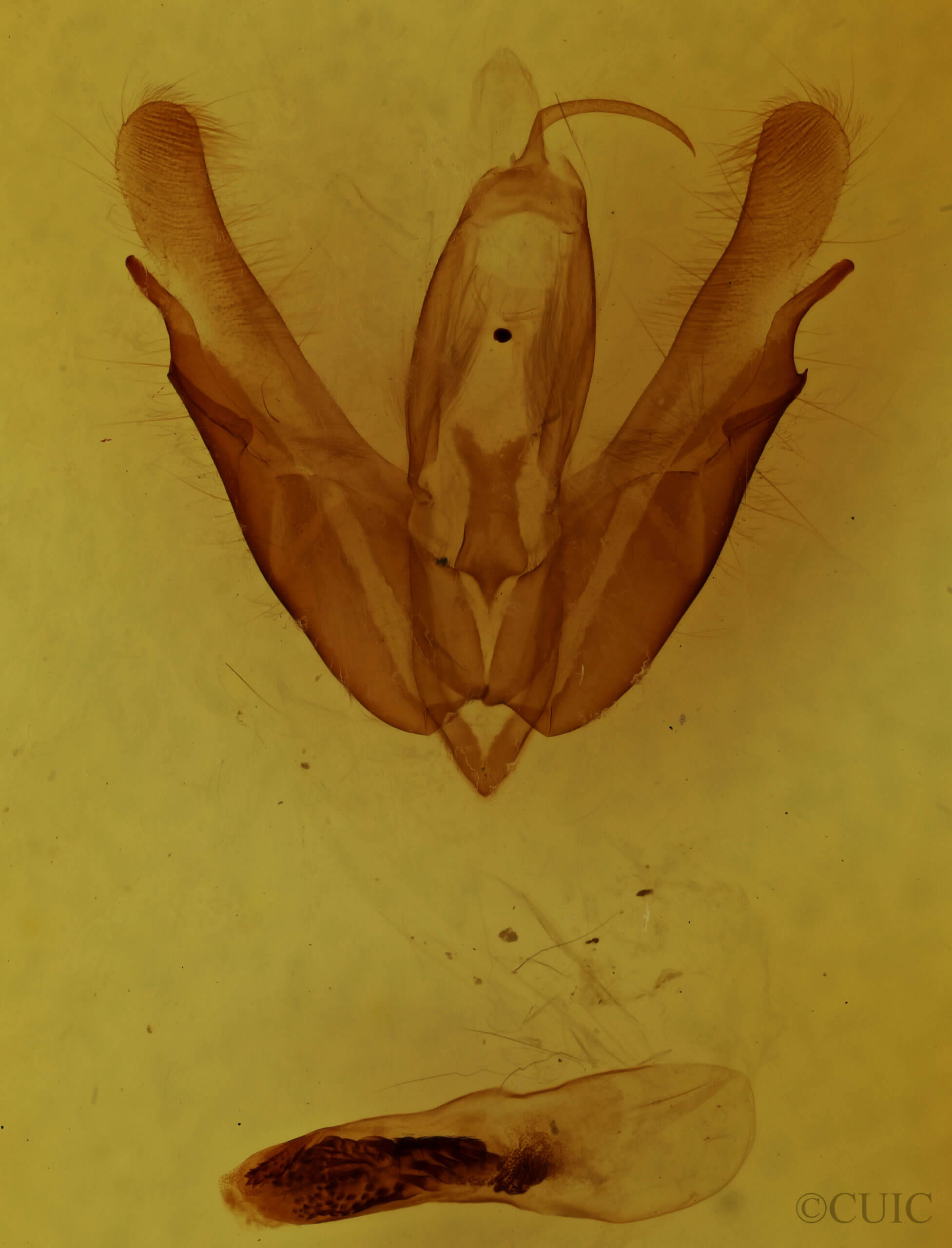 genitalia view of adult Acronicta hasta