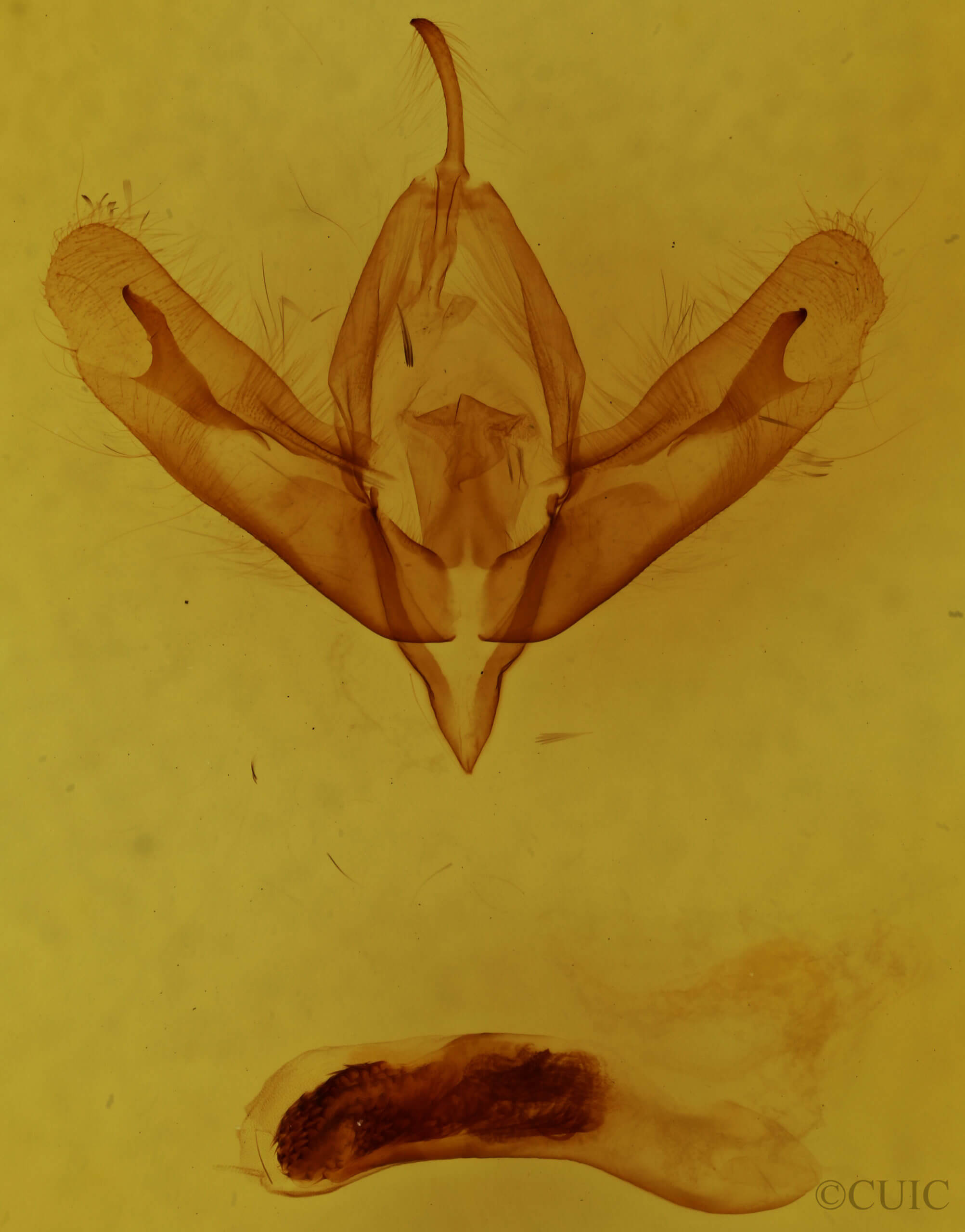 genitalia view of adult Acronicta increta