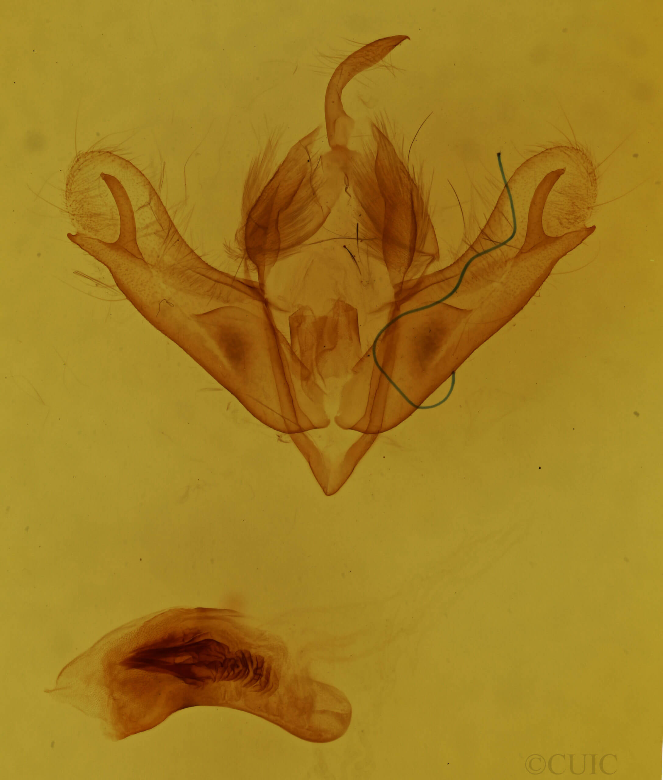 genitalia view of adult Acronicta noctivaga