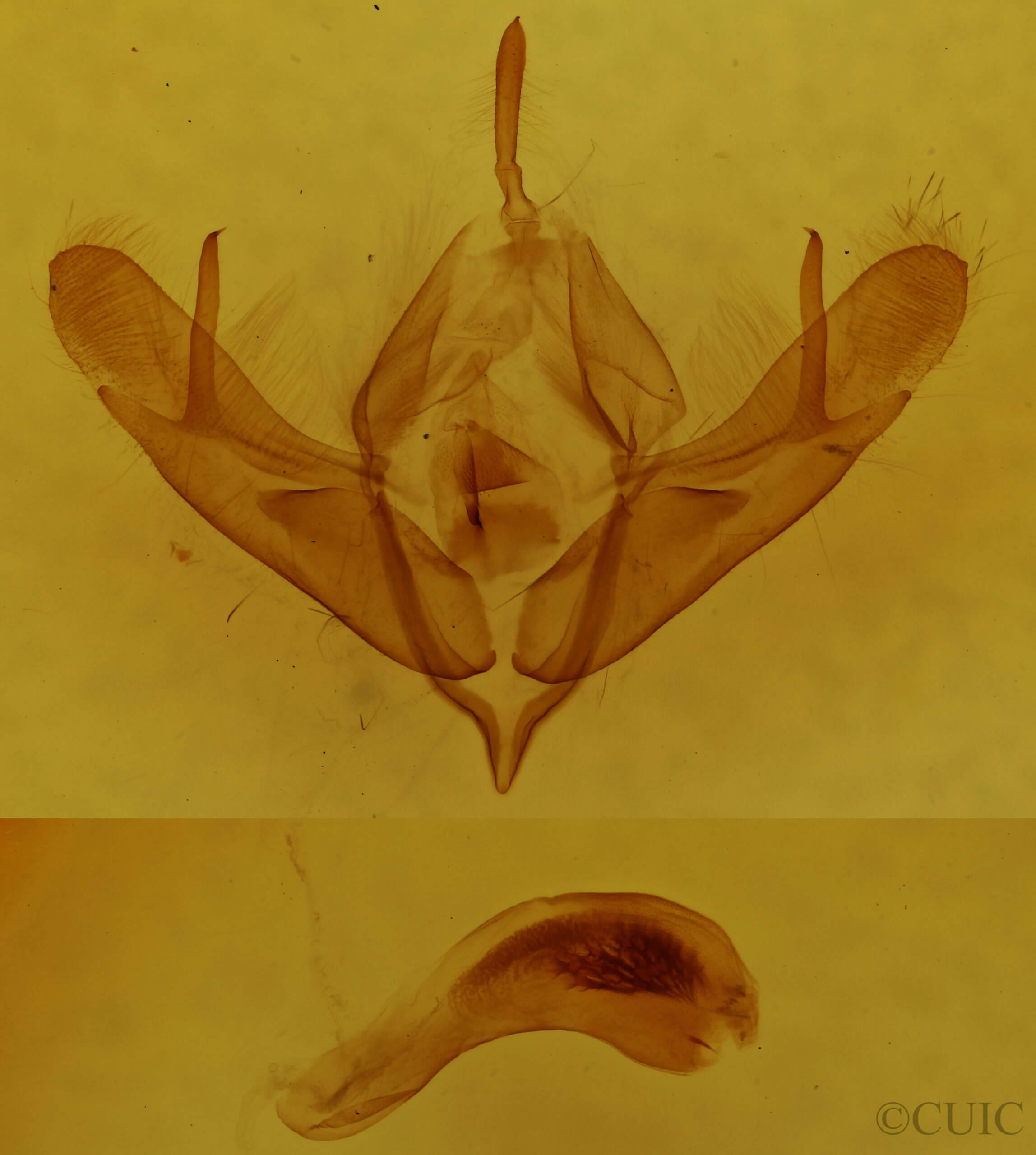 genitalia view of adult Acronicta oblinita